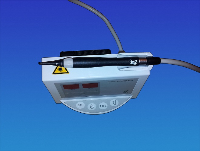 KaVo DIAGNOdent 2095 Laser zur Kariesfrüherkennung mit einer Sonde thumbnail 2