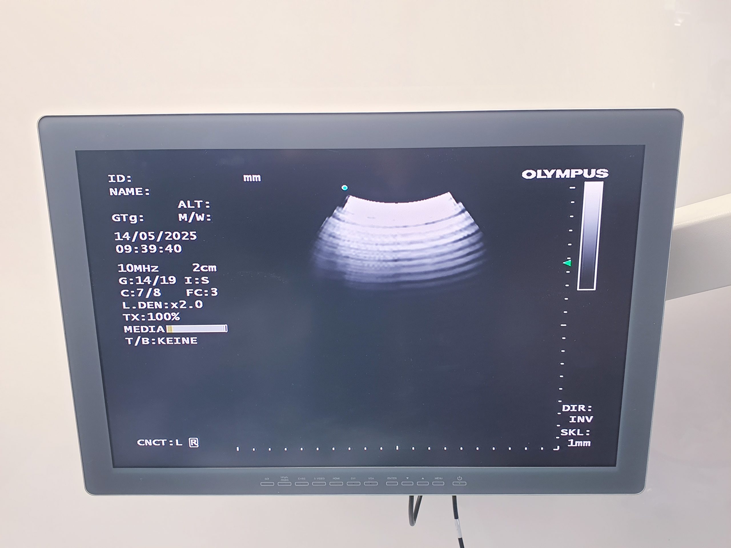 Olympus BF-UC190F Ultraschall Bronchoskope – Bronschoskop thumbnail 14