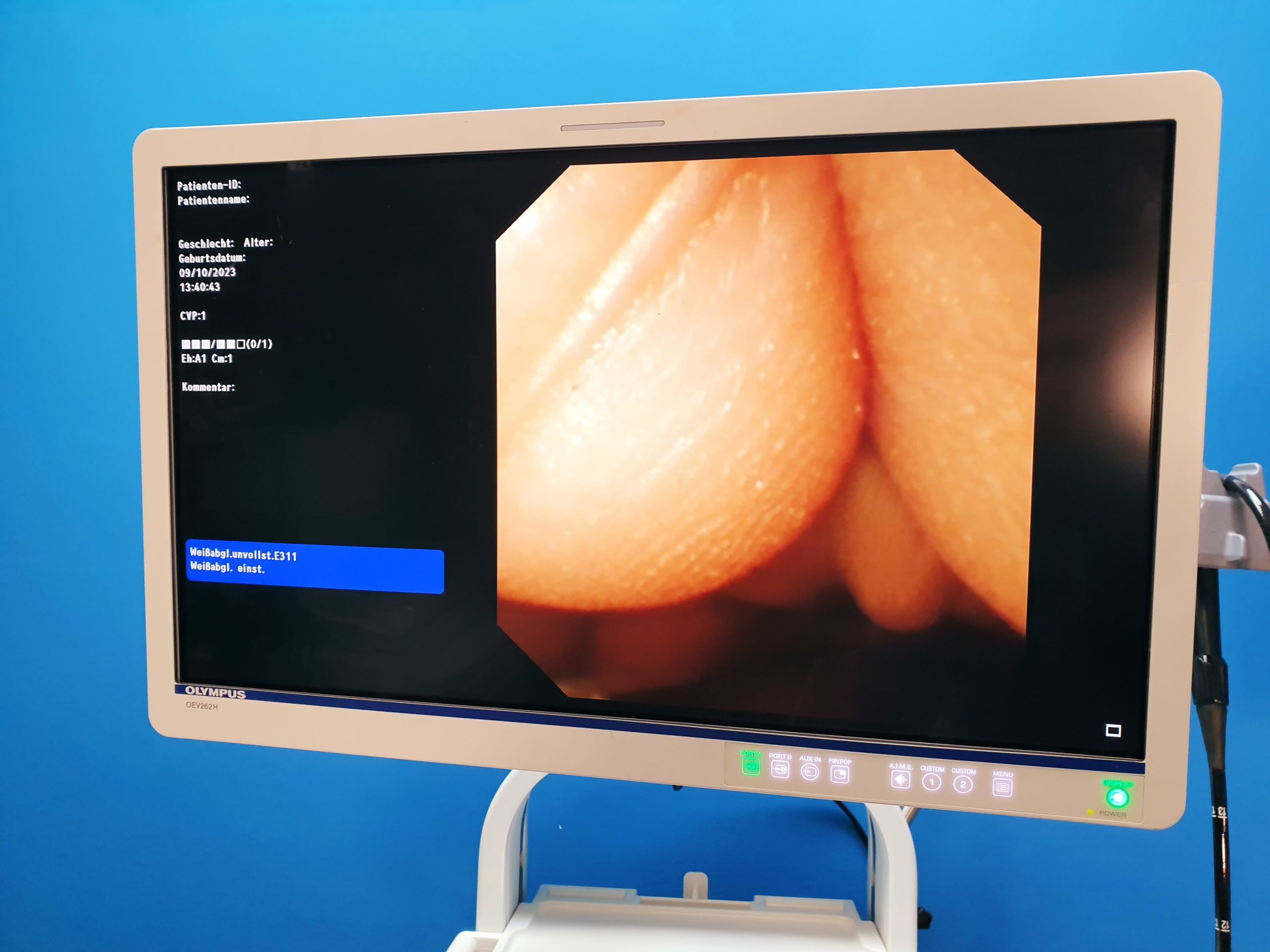 OLYMPUS URF-Videourethoroscope Uretheroskop — image 1 of 11