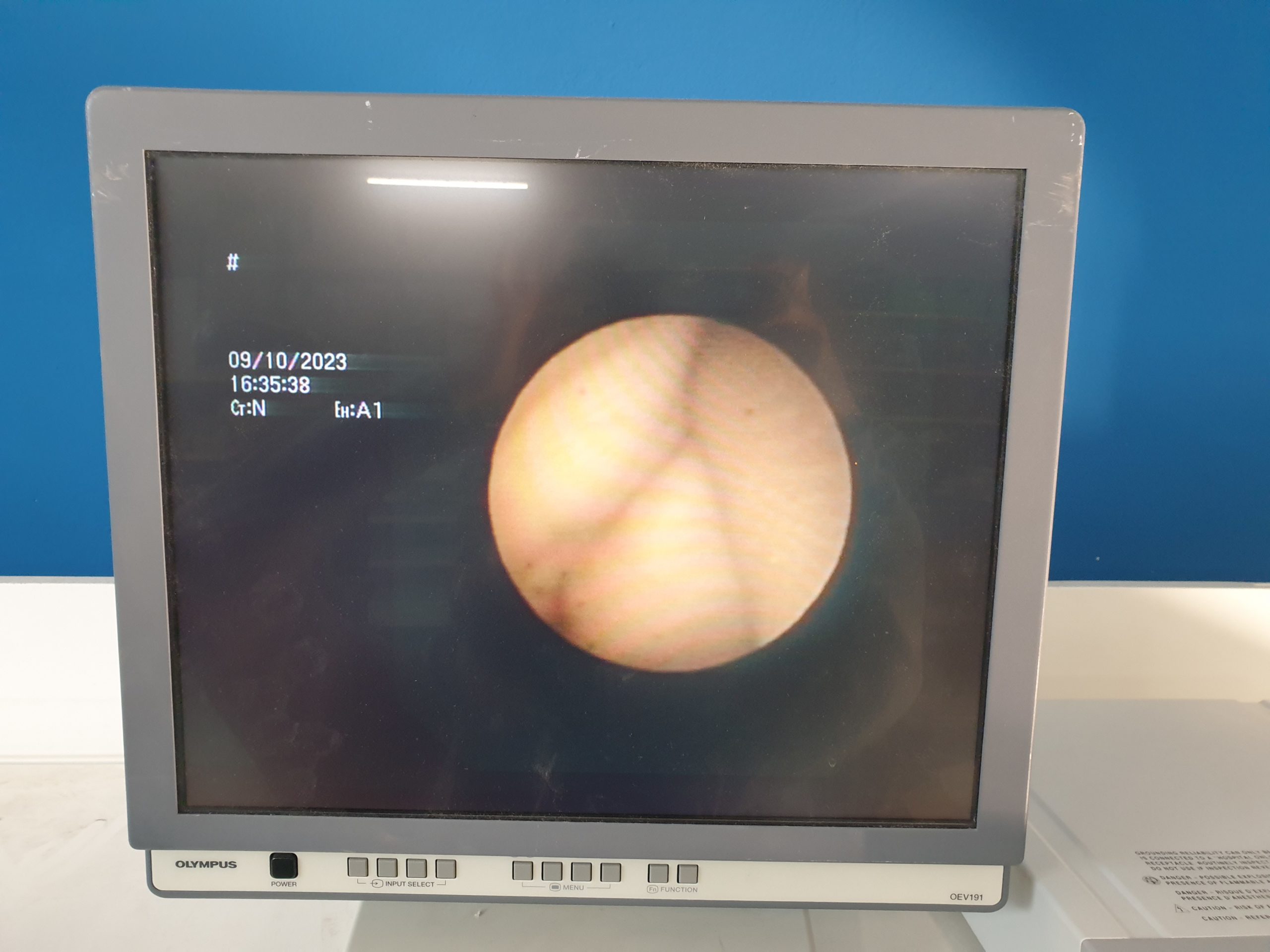 Olympus BF-UC180F Ultraschall Bronchoskop – CCD Heil thumbnail 2