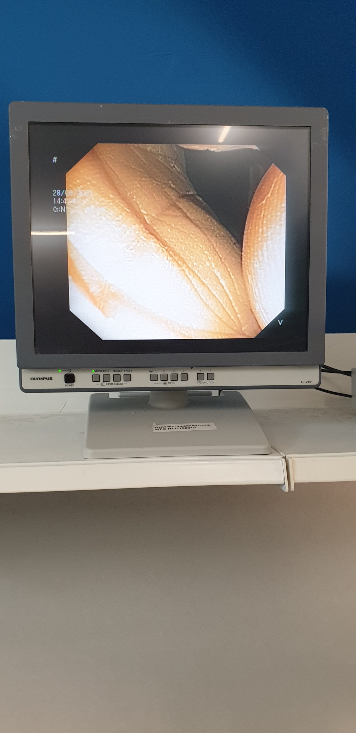 Olympus TJF Q 180 V // OLYMPUS TJF-Q180V Video Duodenoscope – Videoduodenoscope, 4.2 mm working channel thumbnail 3