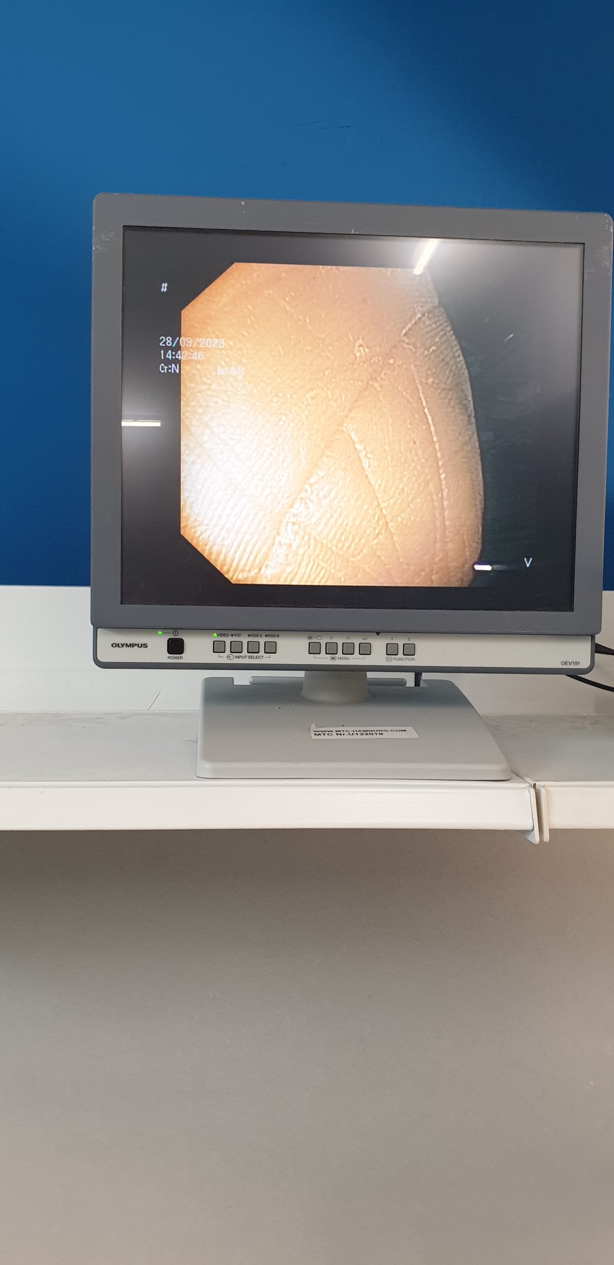 Olympus TJF Q 180 V // OLYMPUS TJF-Q180V Video Duodenoscope – Videoduodenoscope, 4.2 mm working channel thumbnail 4