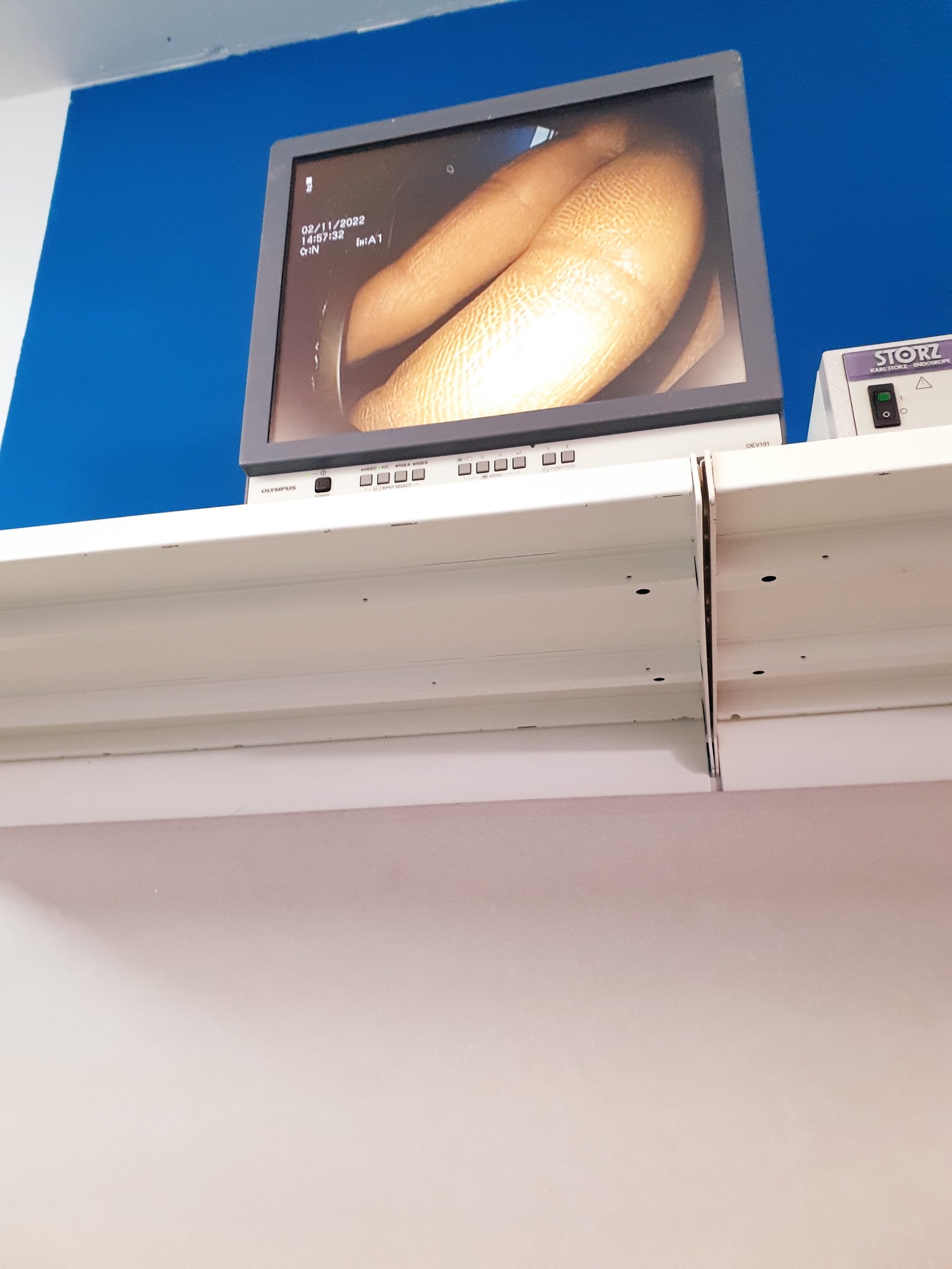 Olympus GIF-Q165 – GIF Q 165 Gastroskop – Teilweise Zerlegt – CCD Heil thumbnail 6