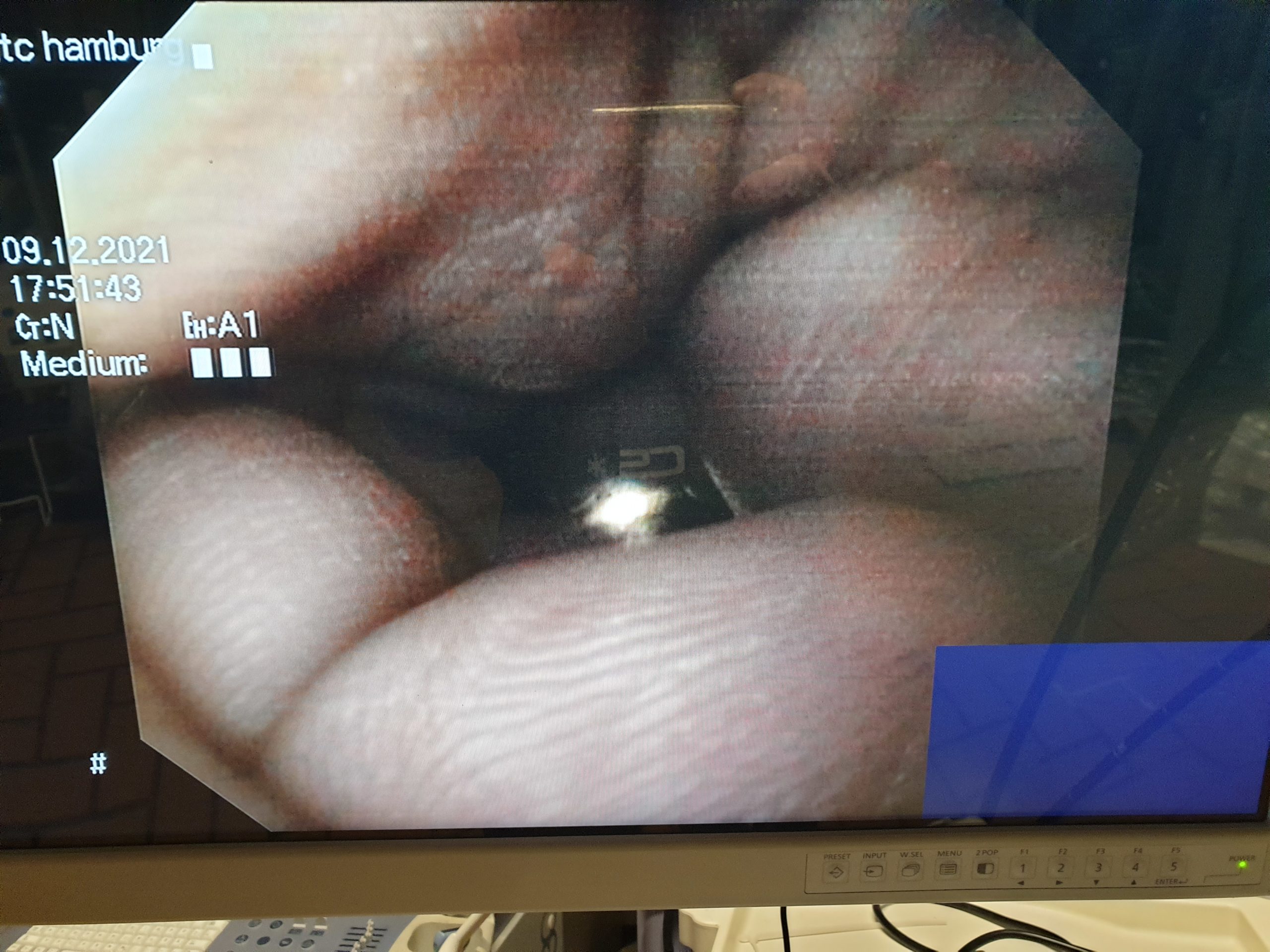 Olympus GIF-Q145 Gastroskop thumbnail 2