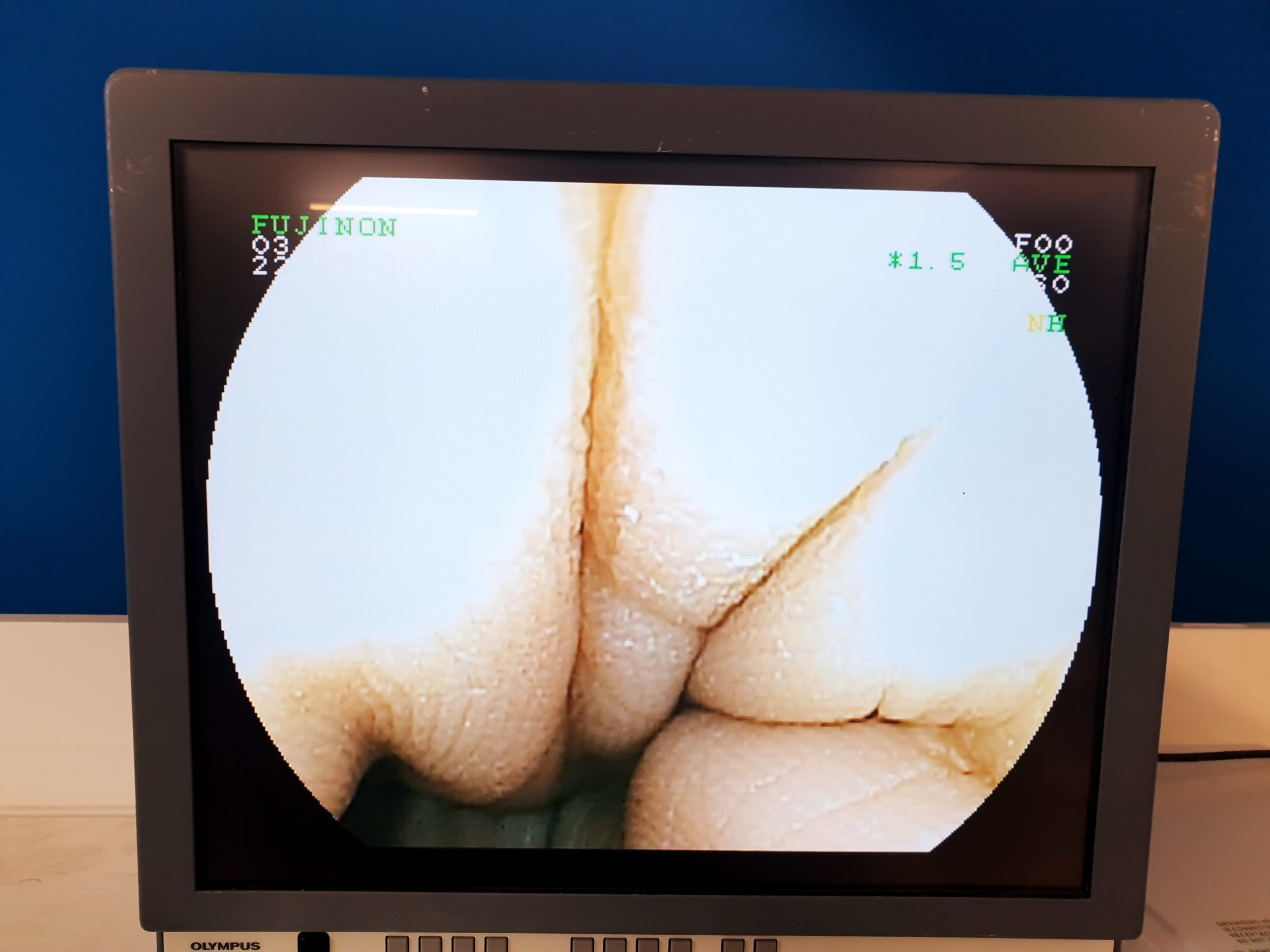 Fujinon EC-530WI EC 530 WI Colonoscope Kolonoskop thumbnail 2