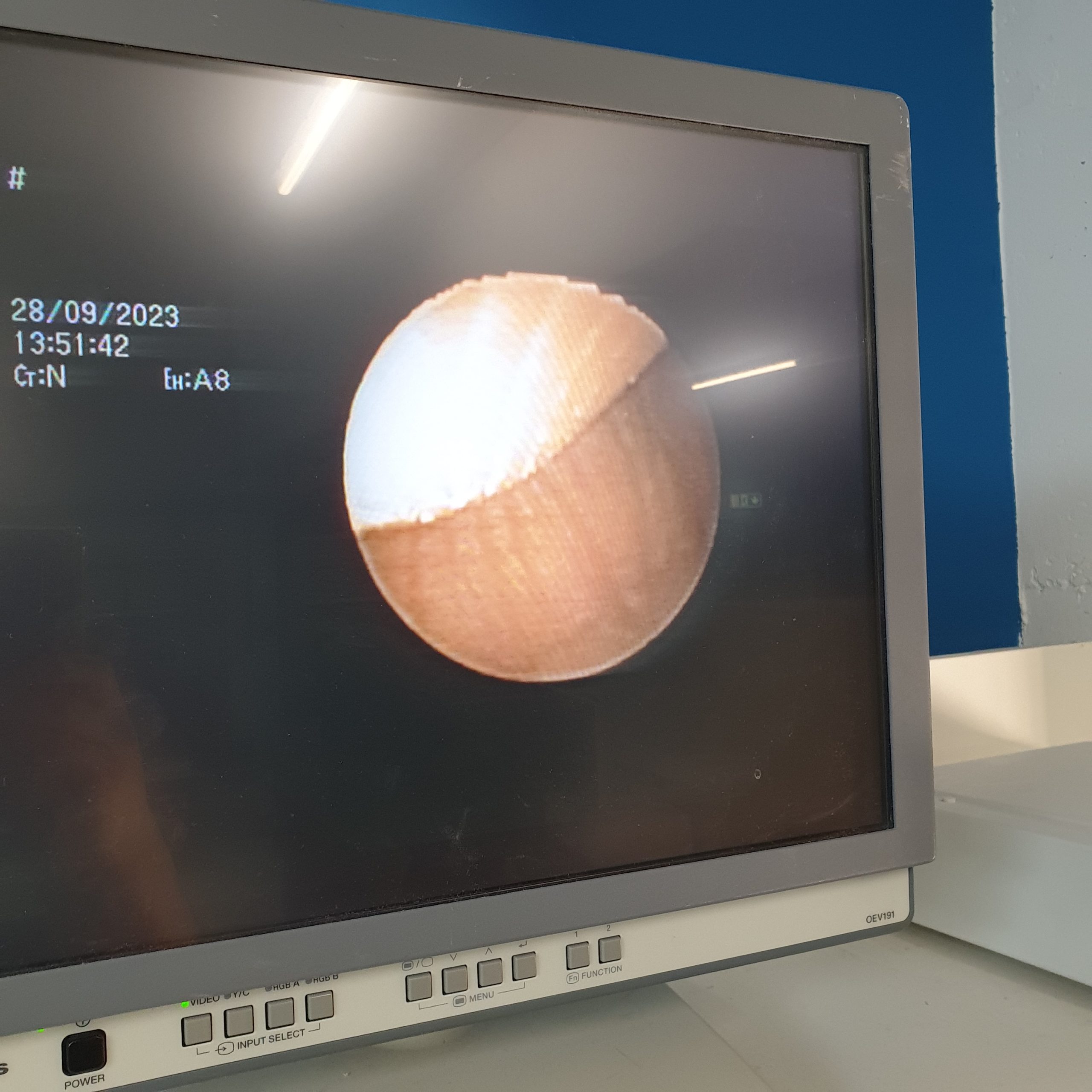 Olympus BF-UC180F Ultraschall Bronchoskop thumbnail 2