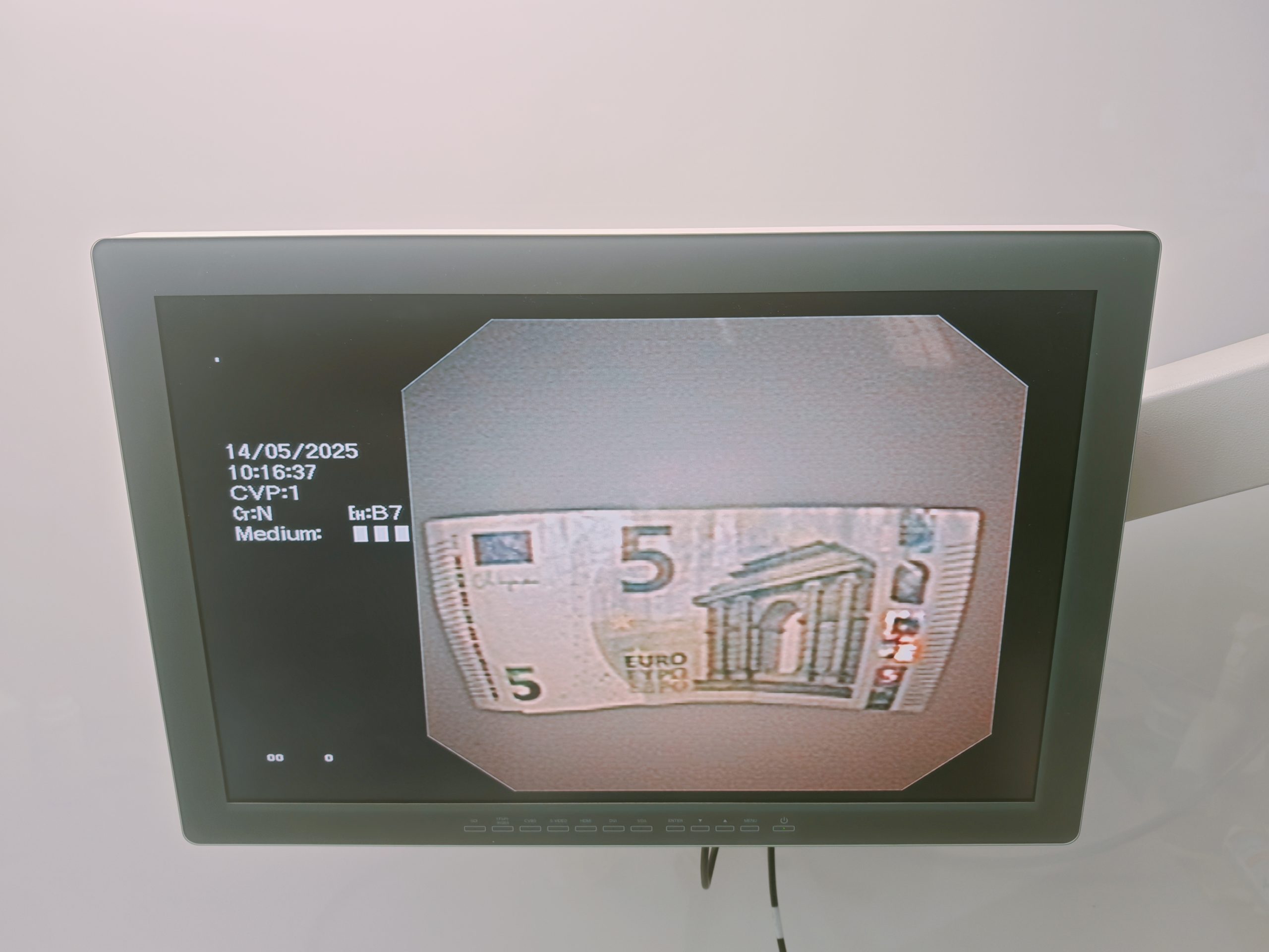 Olympus GIF-2T160 GIF 2T 160 Videogastroskop thumbnail 5