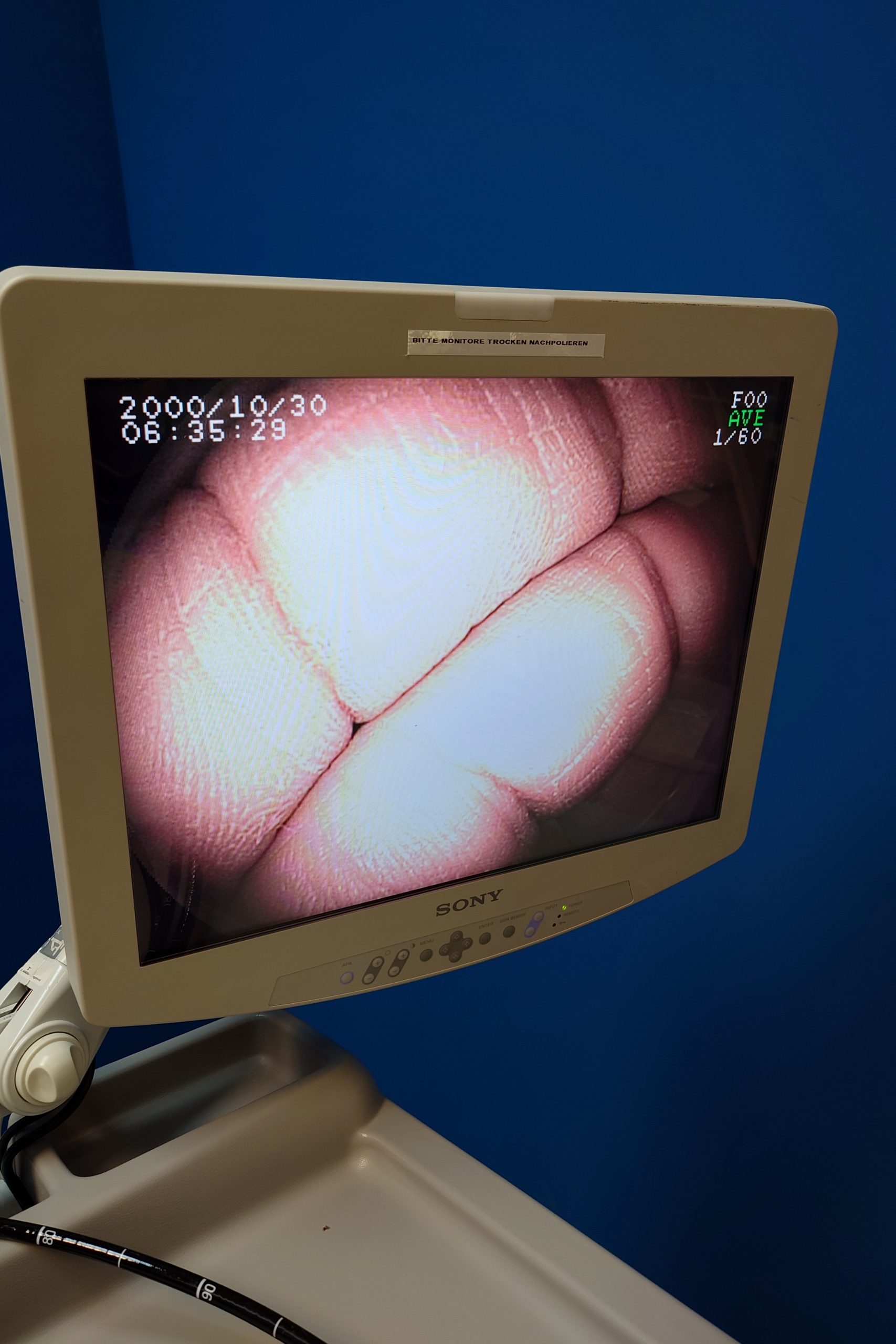 Fuji – Fujinon System 4400 – EG-590ZW GASTROSKOP + EC590ZWL KOLOSKOP + EN-450T5 – enteroscope thumbnail 5