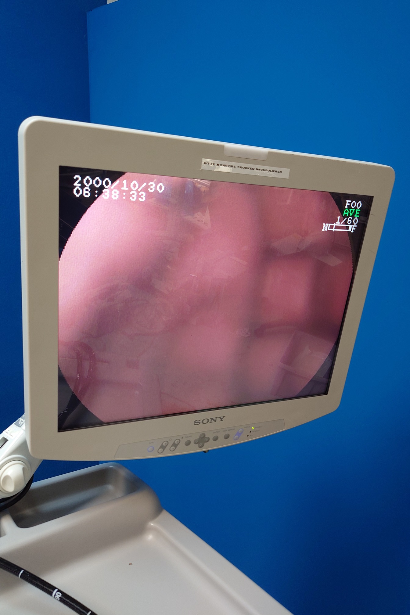 Fuji – Fujinon System 4400 – EG-590ZW GASTROSKOP + EC590ZWL KOLOSKOP + EN-450T5 – enteroscope thumbnail 6
