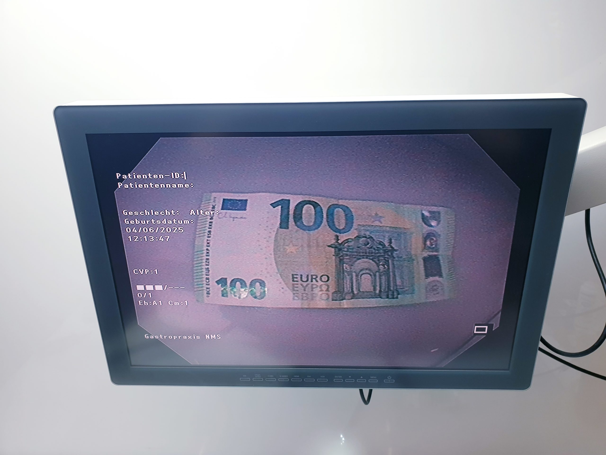 Olympus CF-H170L Videokolonoskop – Kolonoskop thumbnail 9
