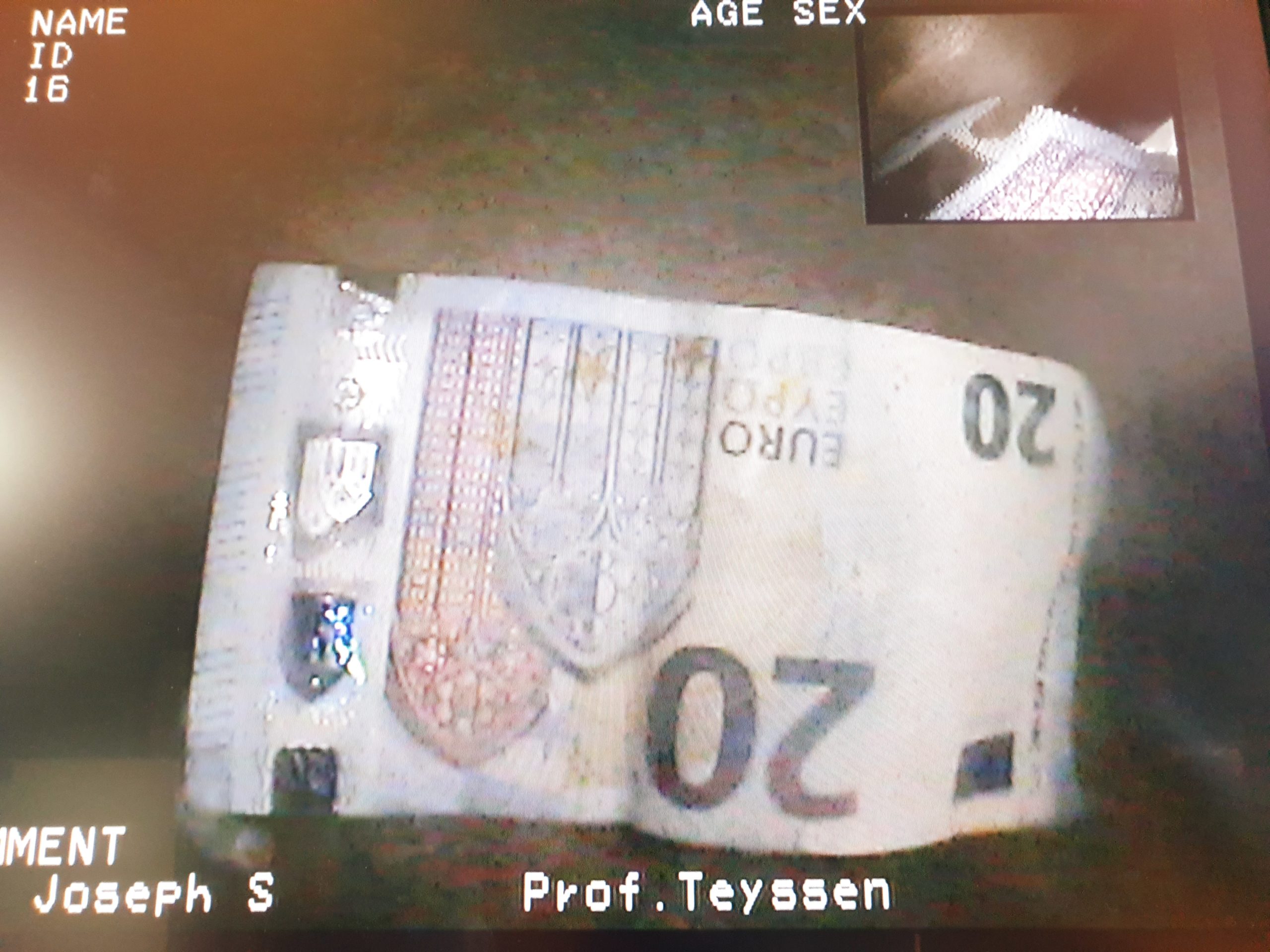 Pentax ED-3490TK Videoduodenoskop thumbnail 11