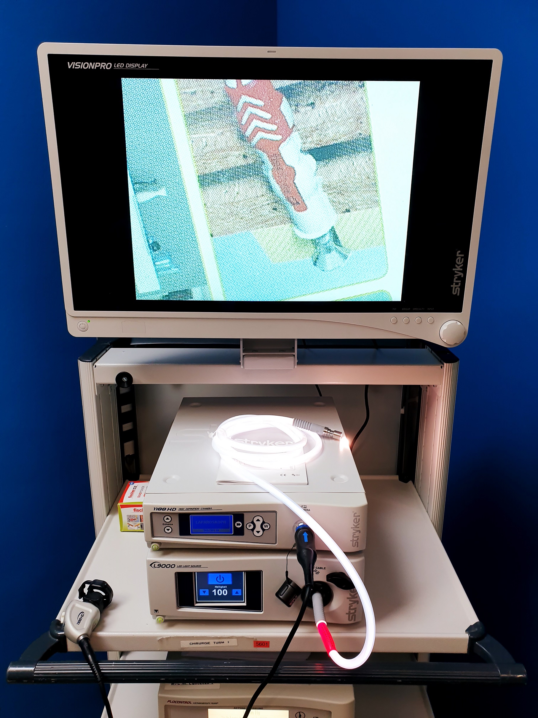 Stryker Turm Arthroskopie Laparaskopie Zystoskopie – 1188HD – L9000 LED Light Source – Stryker FLOCONTROL Arthroskopie Pump – VISIONPRO LED Display – SDC Ultra HD Managment System – thumbnail 3