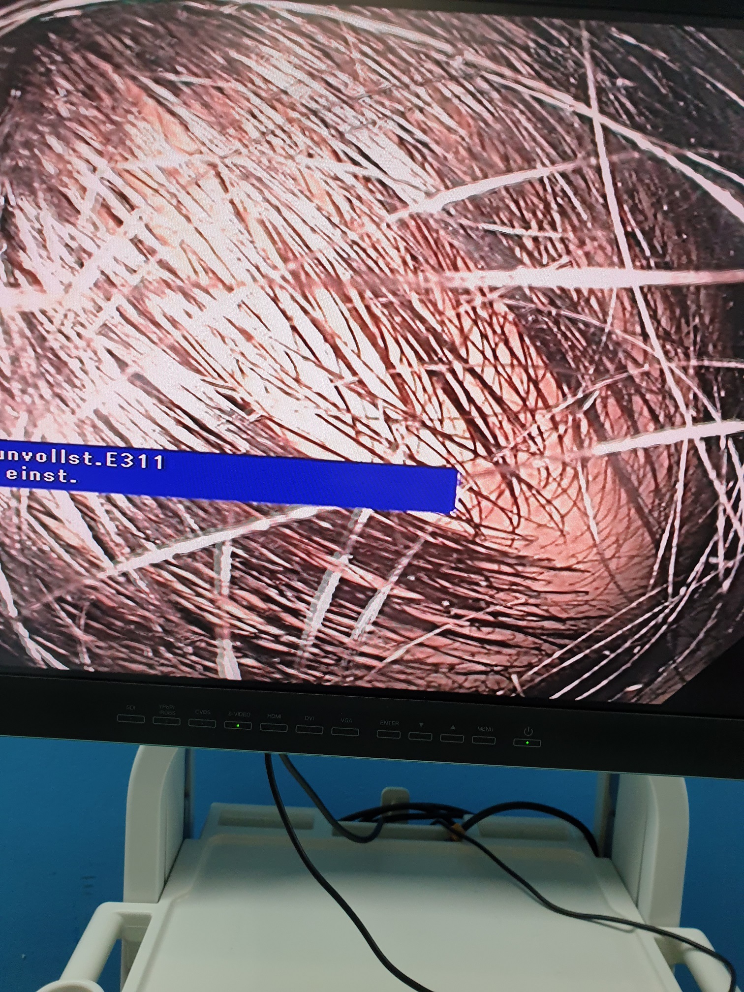 Olympus CV-190 / CLV-190 + CF-HQ190L + GIF-Q190 + MAJ-1430 , … thumbnail 16