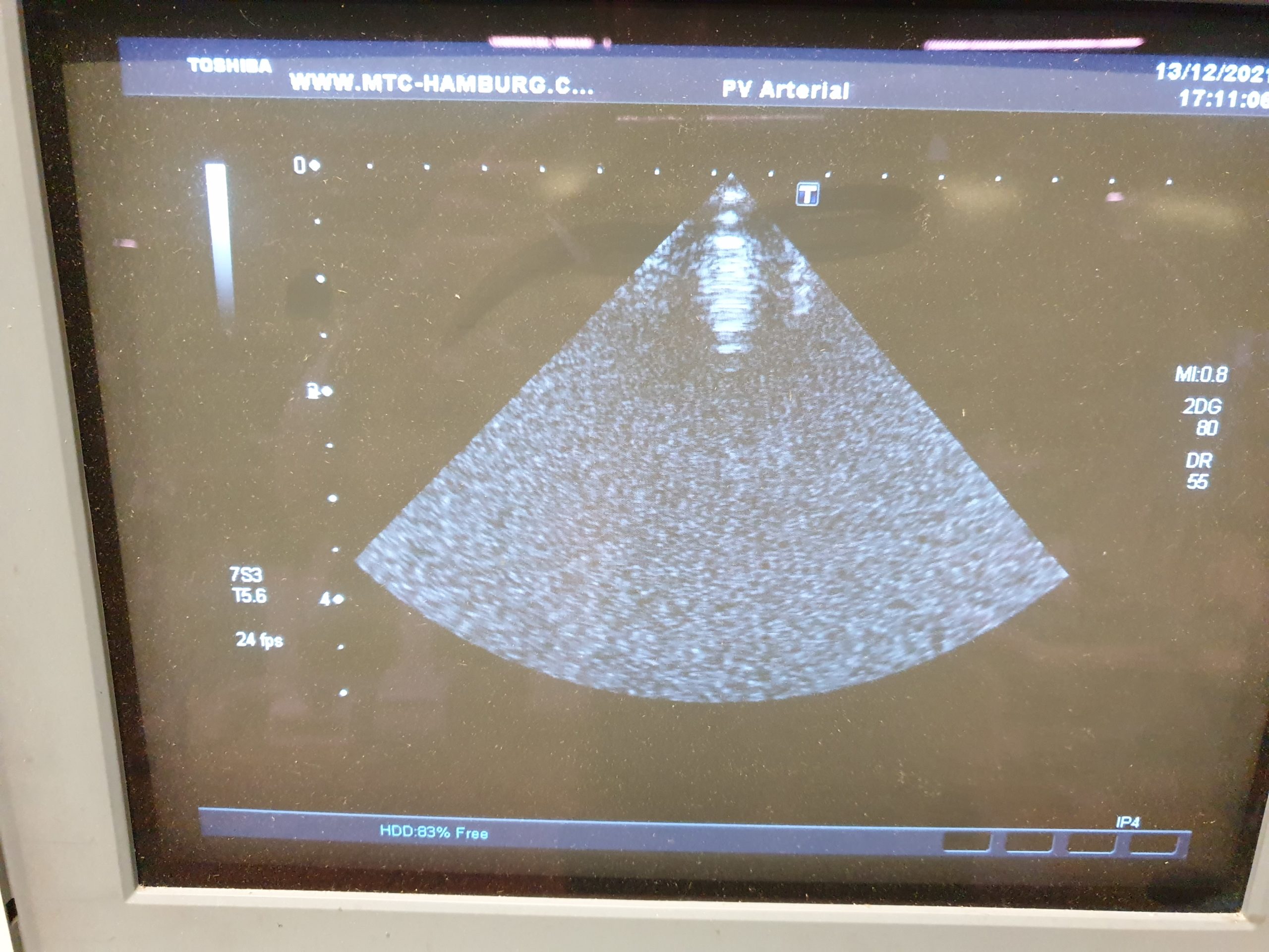 Toshiba PET 510 MA // PET510MA // PET-510MA TEE Ultrasound Probe thumbnail 3