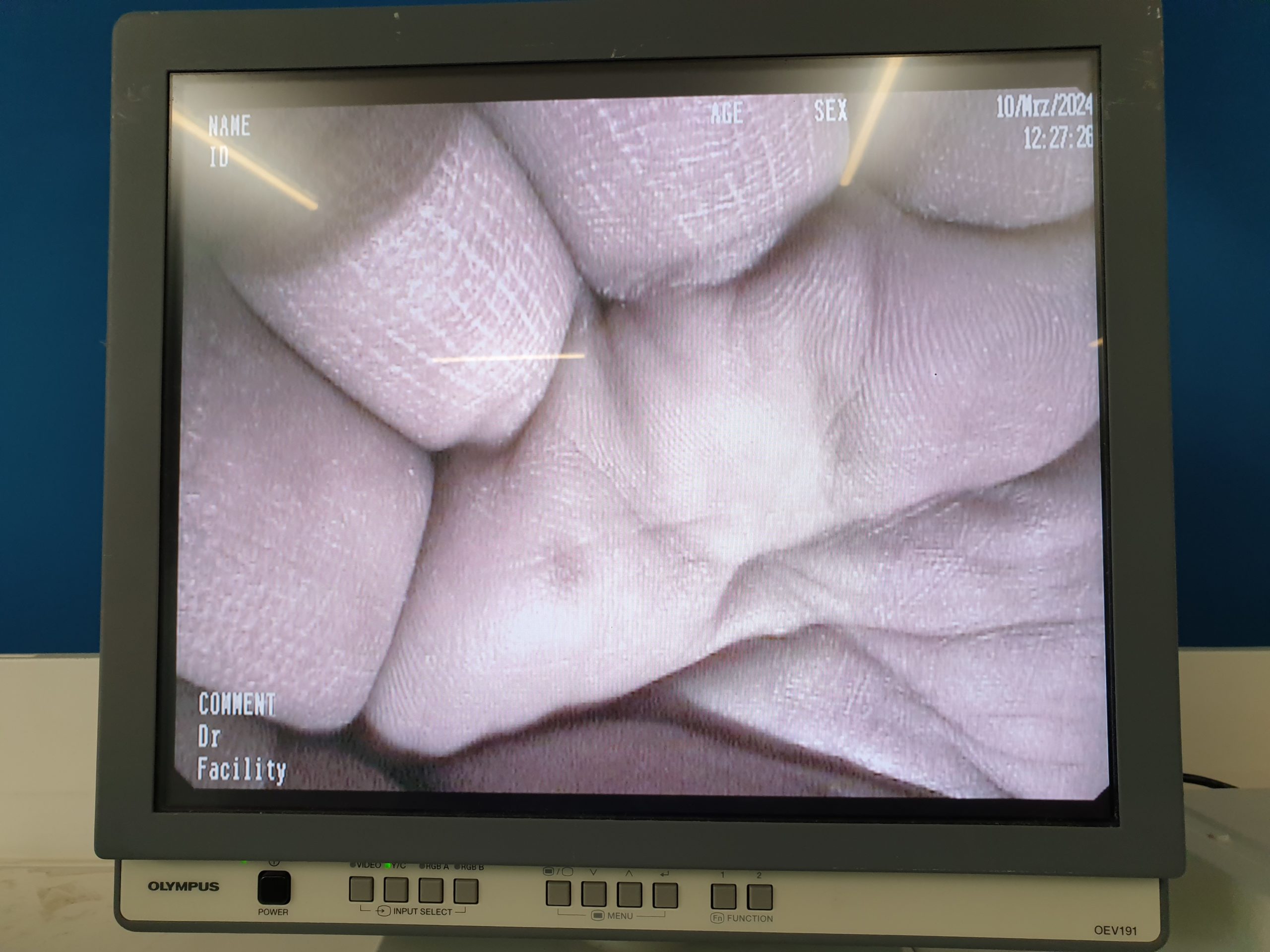 PENTAX EG-3870TK EG 3870 TK Gastroskop thumbnail 14