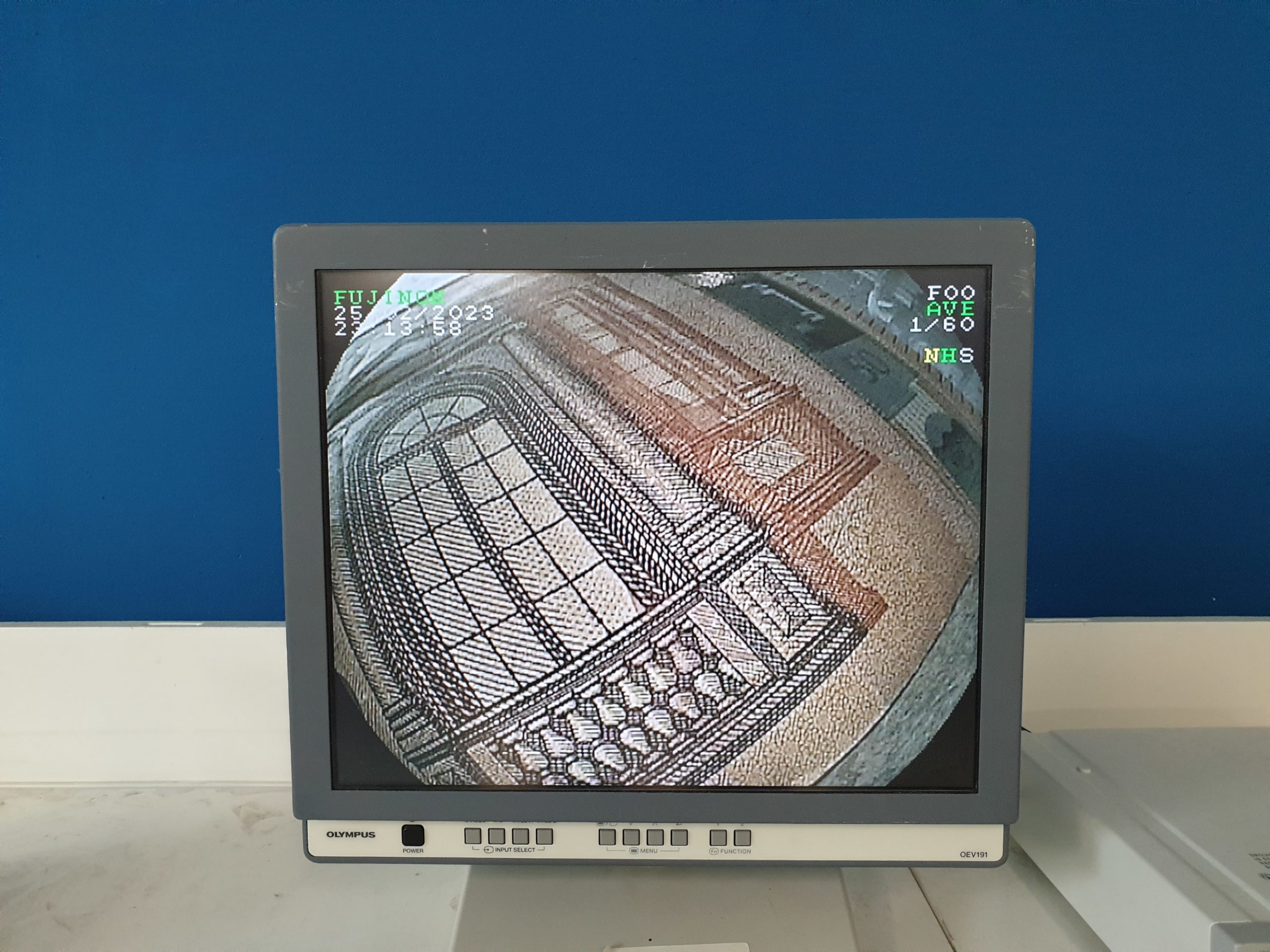 Fujinon Fuji EN-450T5 Enteroskop thumbnail 14