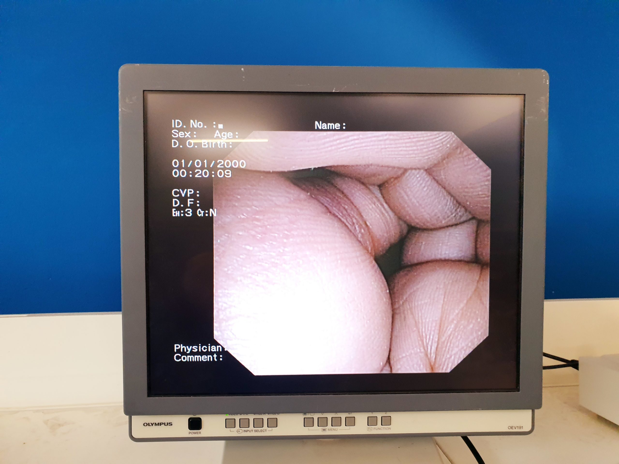 Olympus CV-160 Ecv-160 Evis Exera Video Processor — image 1 of 3