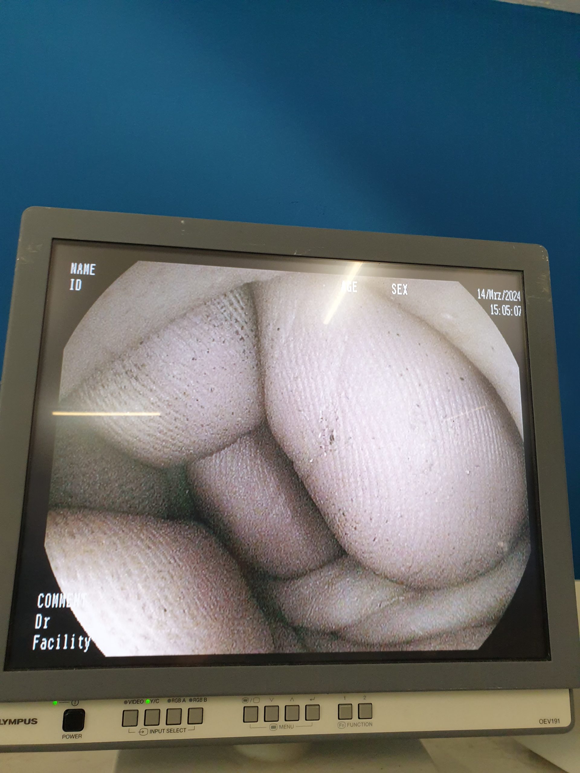 Pentax Pentax EG-2990I EG 2990 i Gastroscope thumbnail 13