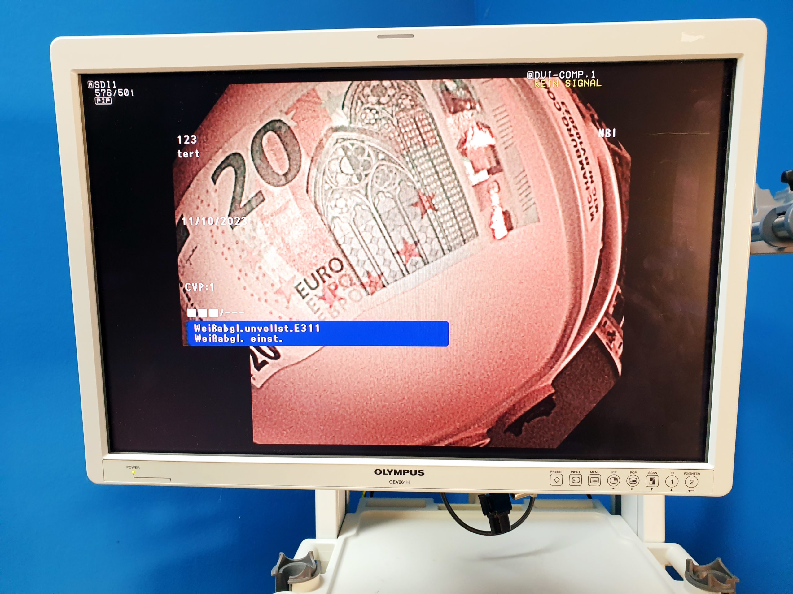 Olympus 190 System CV-190 – CLV190 -CF-H190I – GIF-H190 thumbnail 6