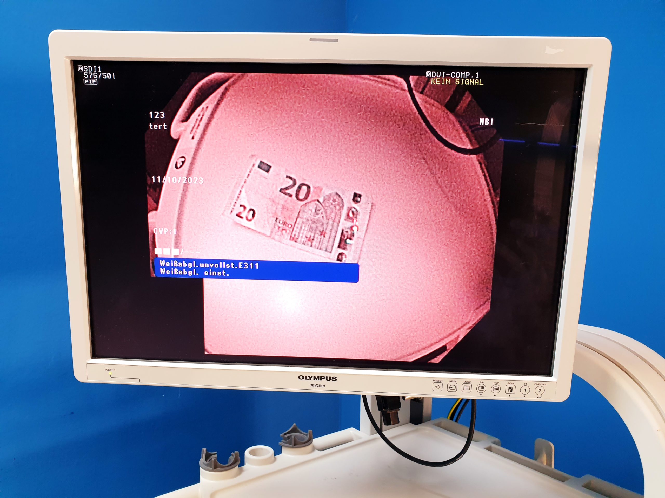 Olympus 190 System CV-190 – CLV190 -CF-H190I – GIF-H190 thumbnail 17