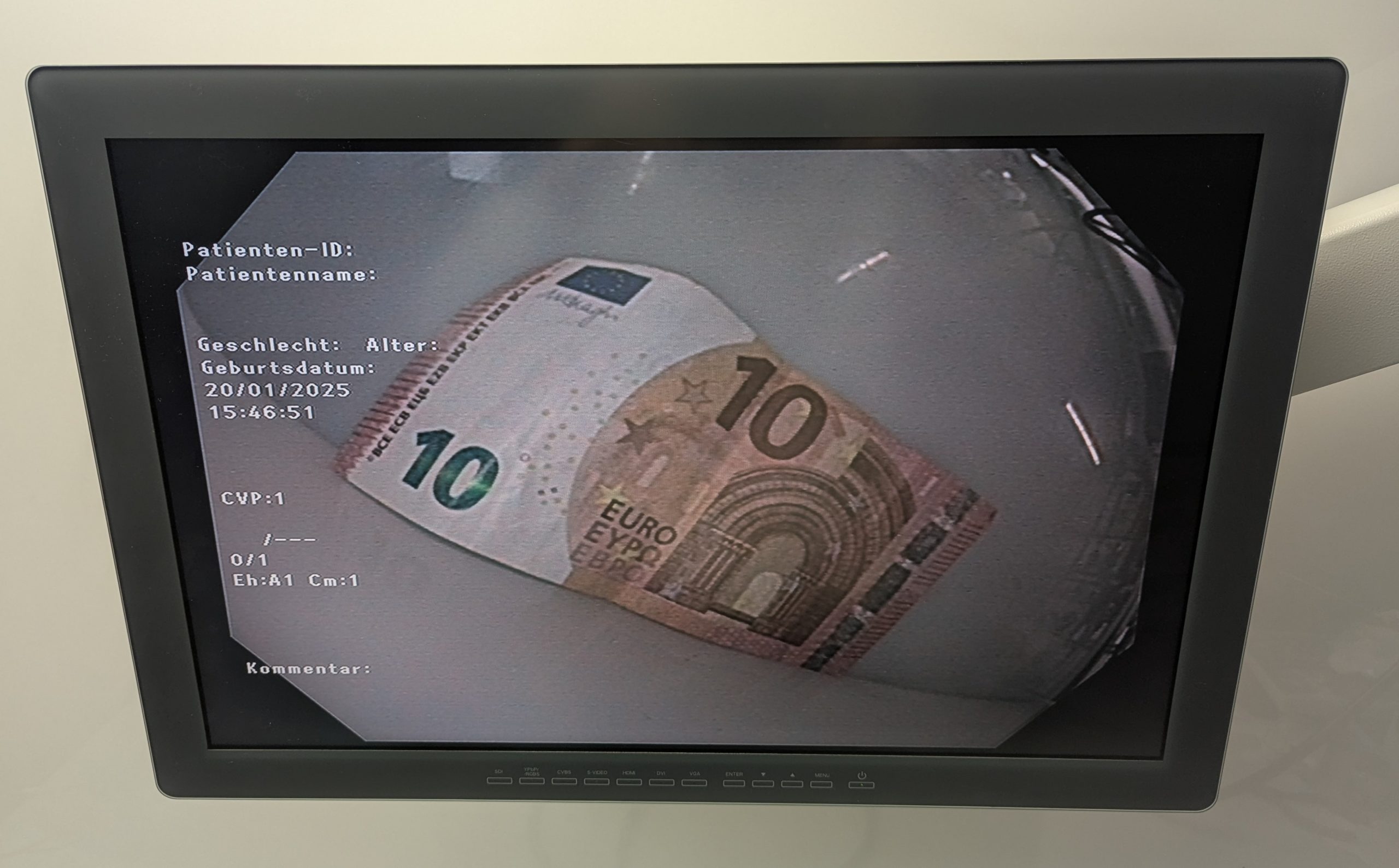 Olympus CF-H190L Videokoloskop HDTV thumbnail 18