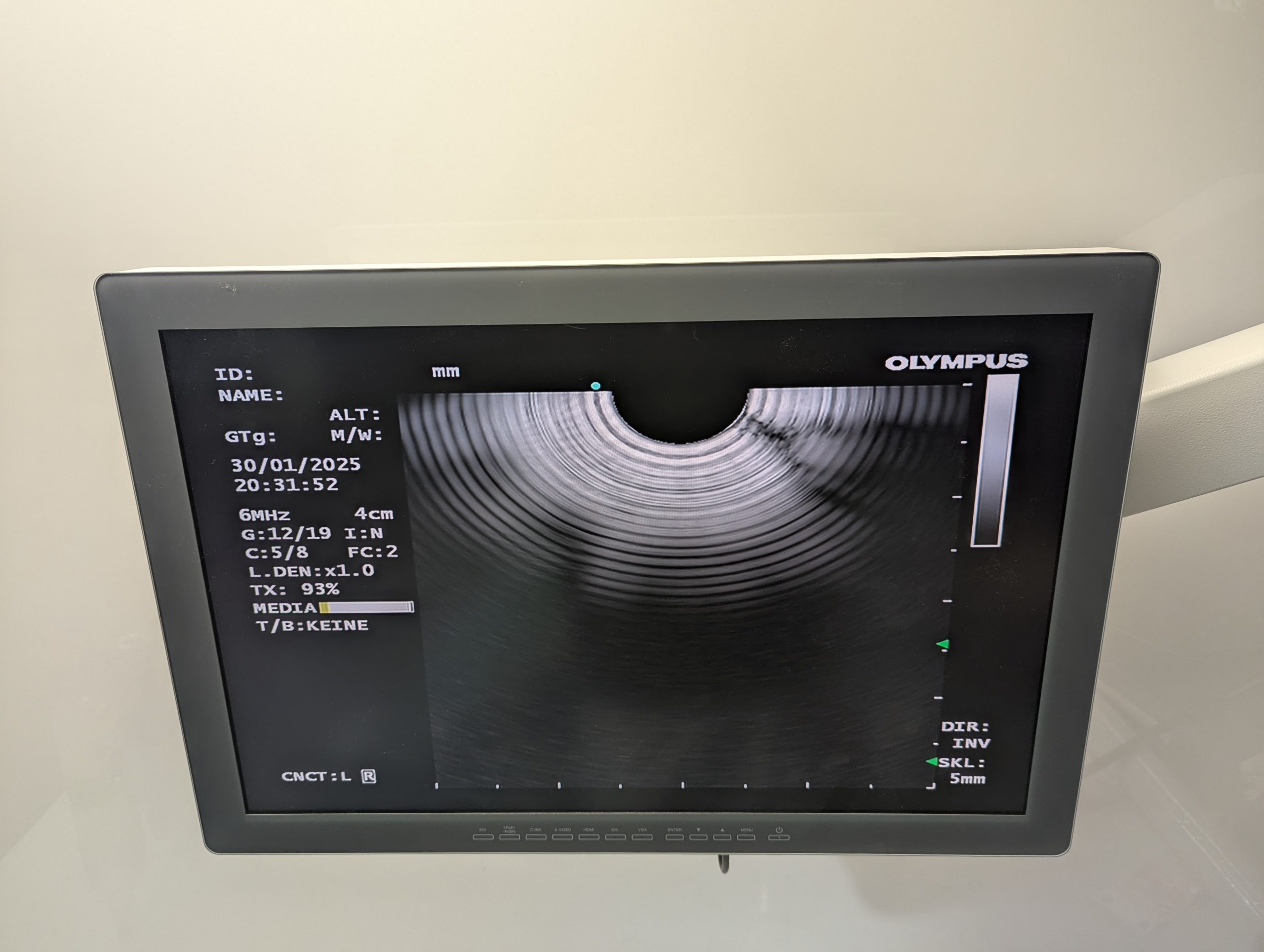 Olympus GF-UCT180 Longitudinales Ultraschallgastroskop thumbnail 19