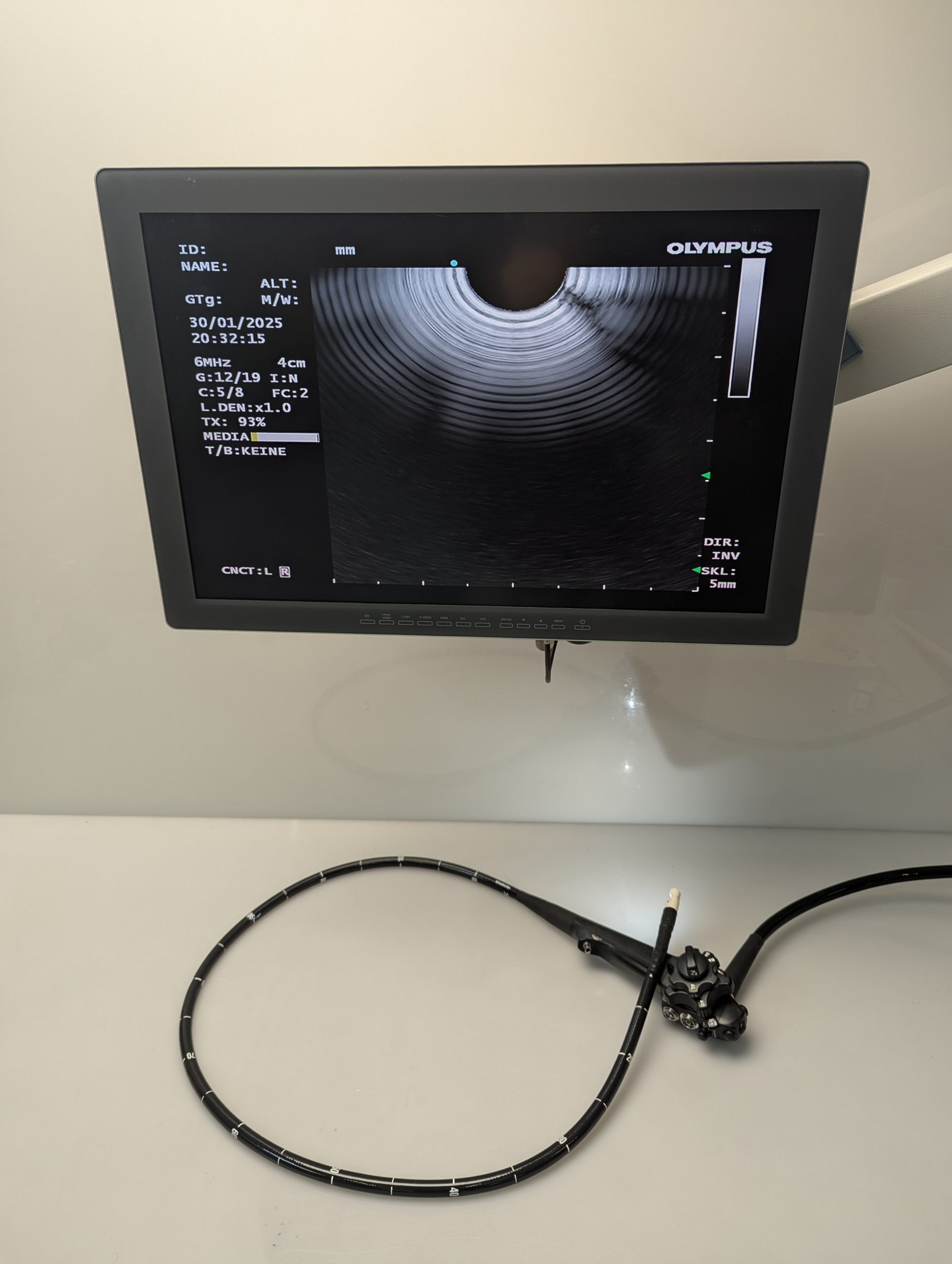 Olympus GF-UCT180 Longitudinales Ultraschallgastroskop thumbnail 20