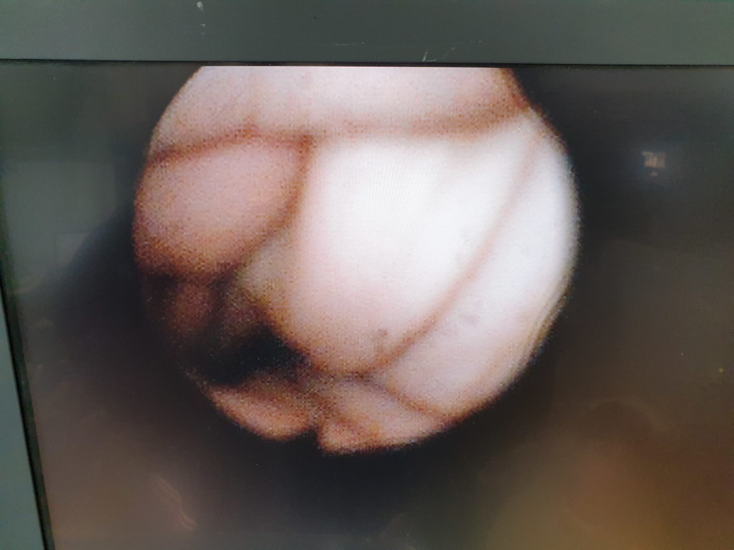 Olympus BF Type TE2 – DEFEKT thumbnail 3