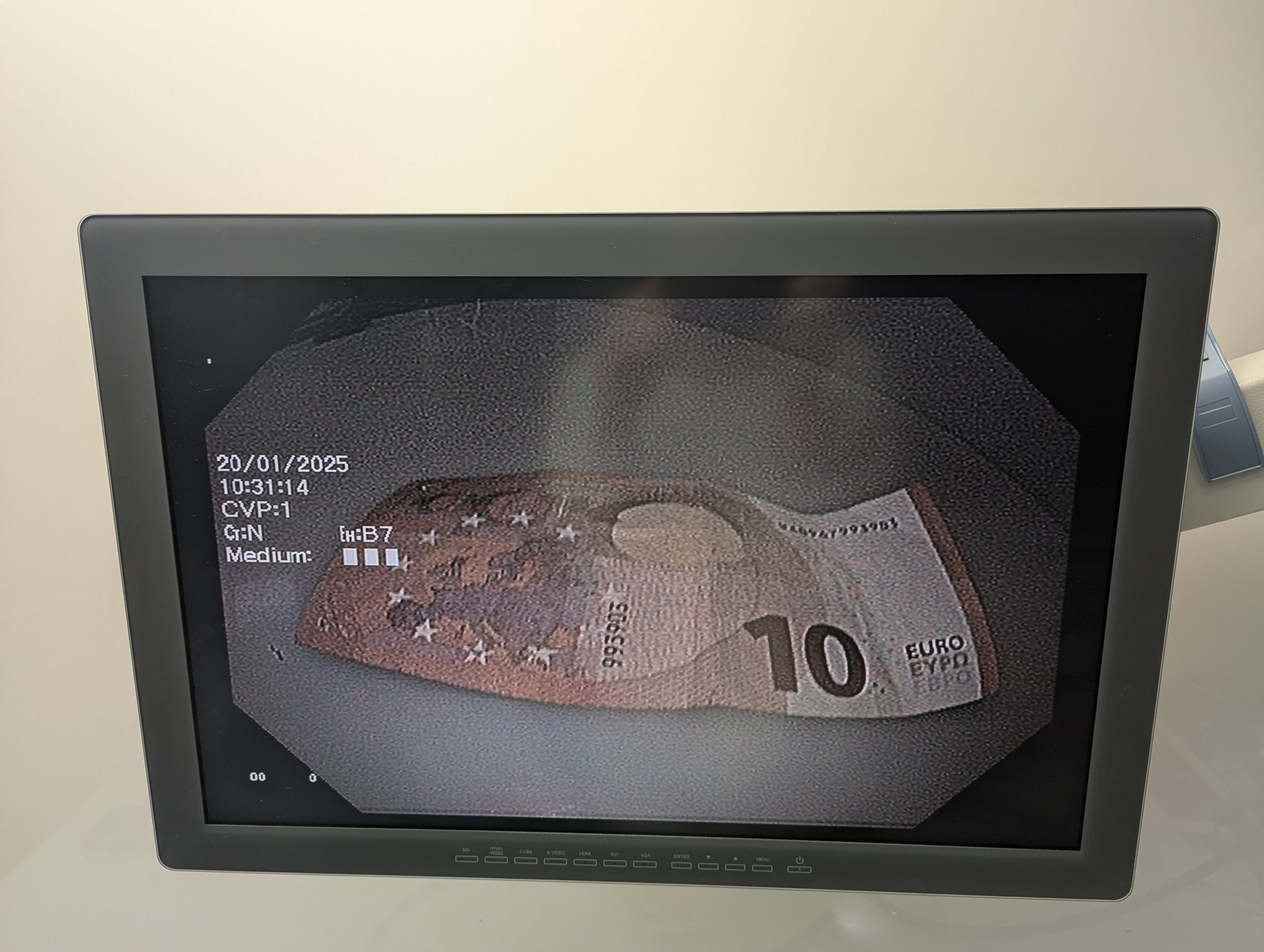 Olympus GIF-H180 HDTV Videogastroskop thumbnail 16