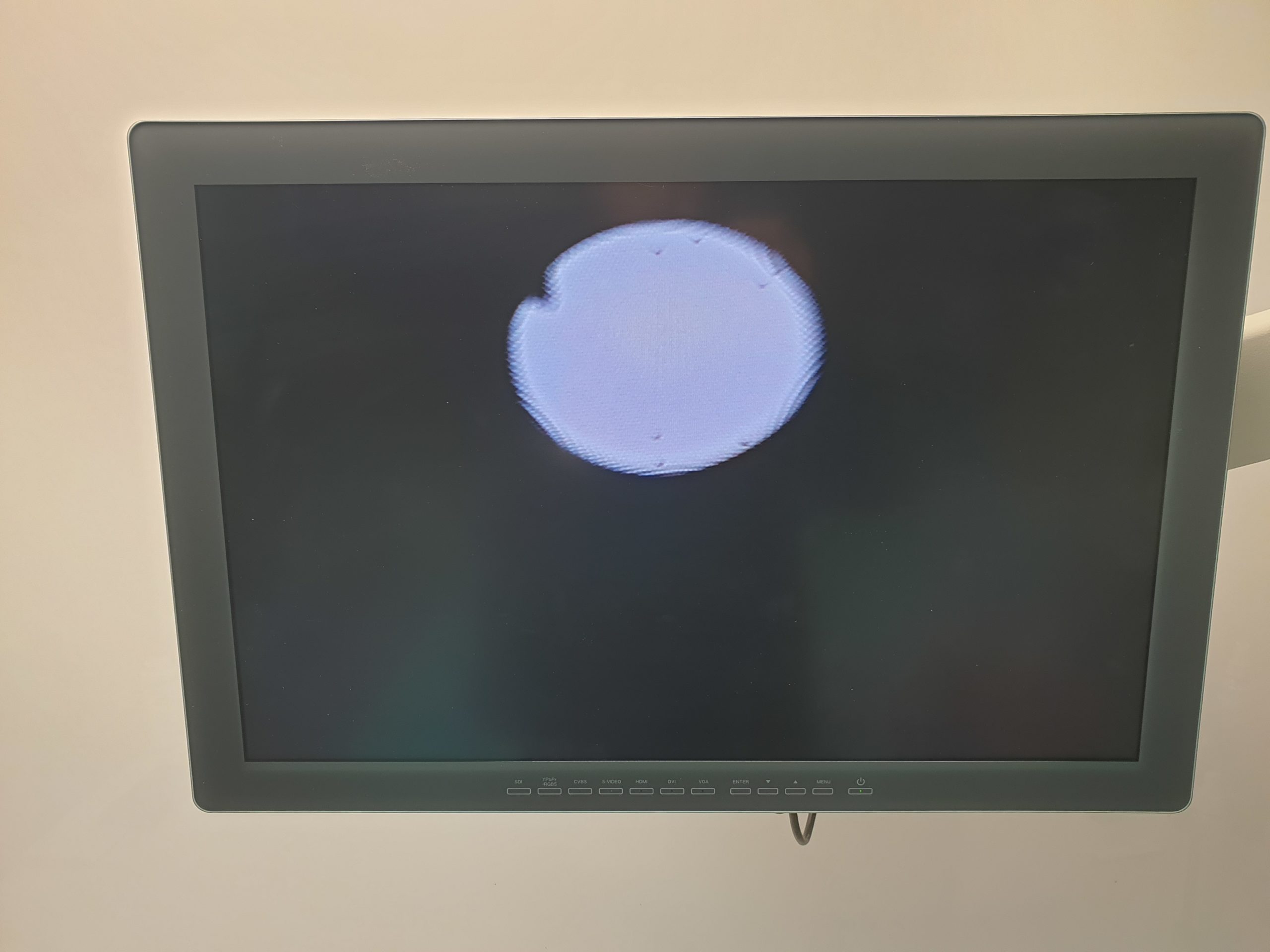 Olympus LF-DP Intubation Scope – Entmantelt 0 Dots Defekt thumbnail 4
