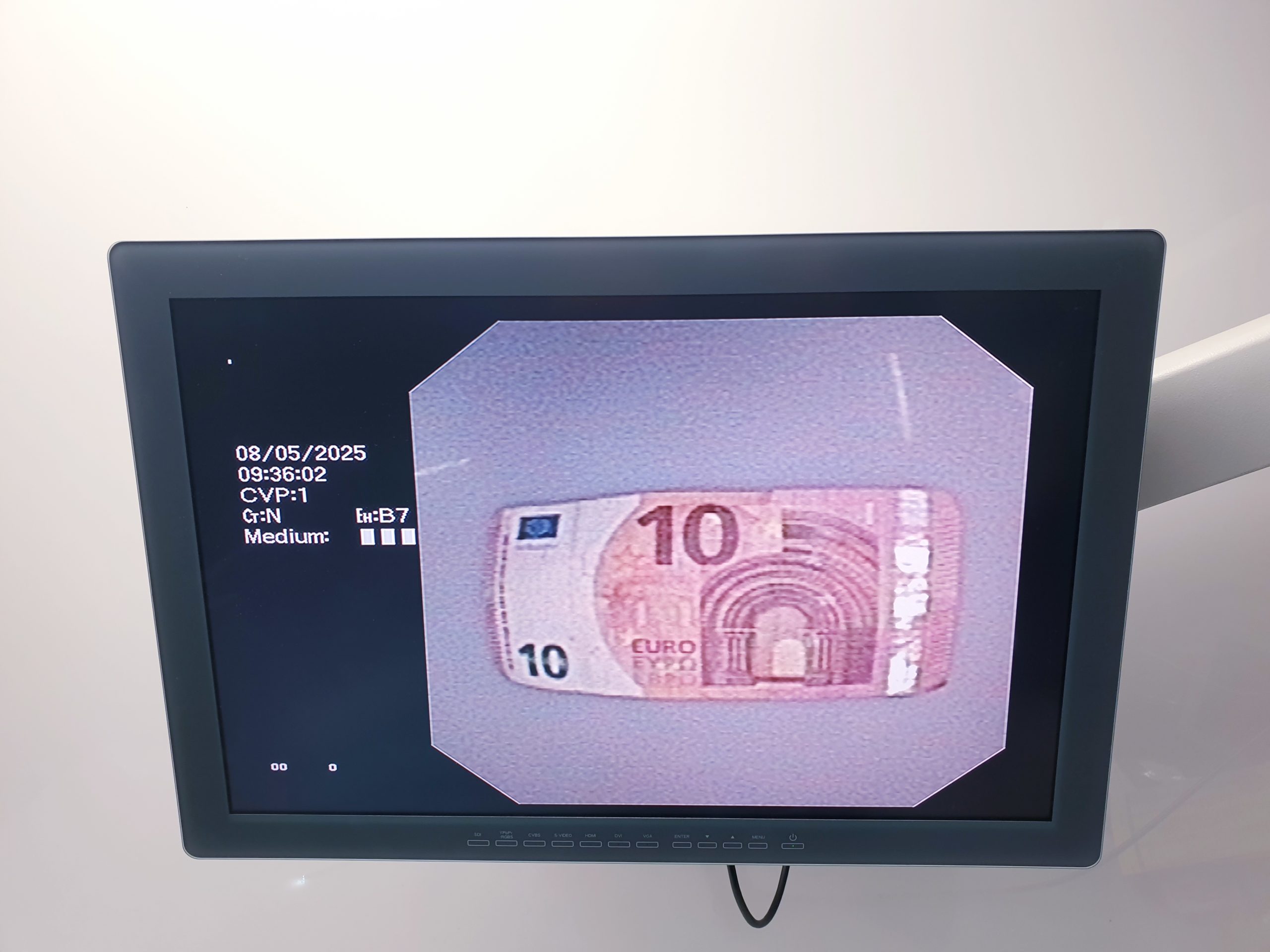 Olympus Evis Exera II BF-P180 BF P 180 Video-Bronchoskop – Videobronchoskop thumbnail 8