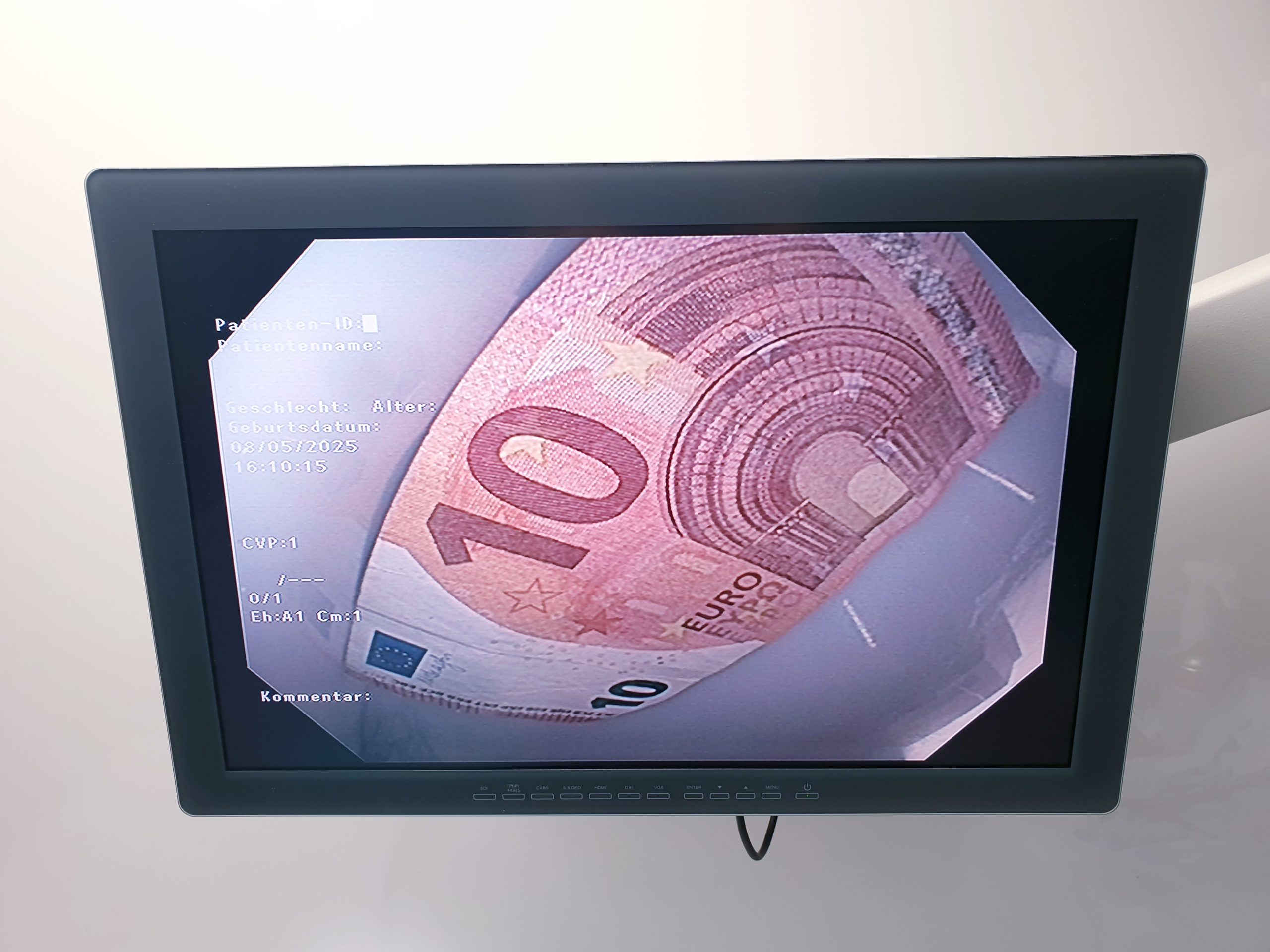 Olympus GIF-1TH190 Gastroskop – Videogastroskop thumbnail 14
