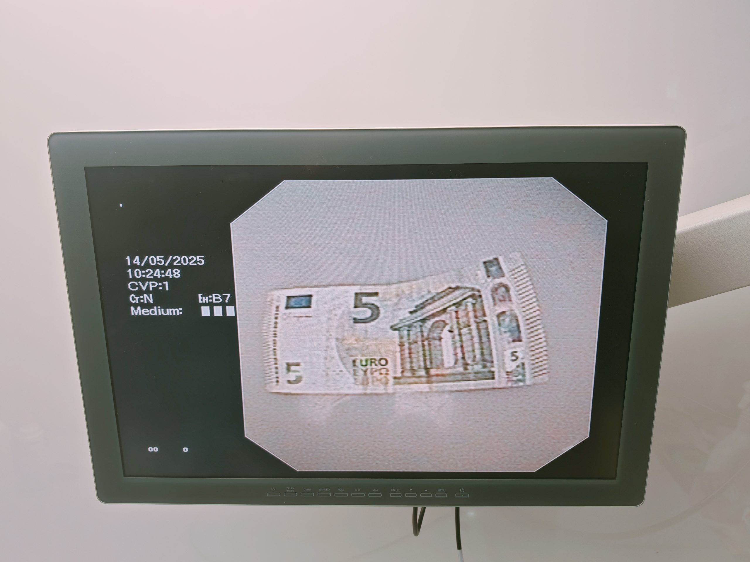 Olympus GIF-N180 Transnasales Gastroskop thumbnail 14