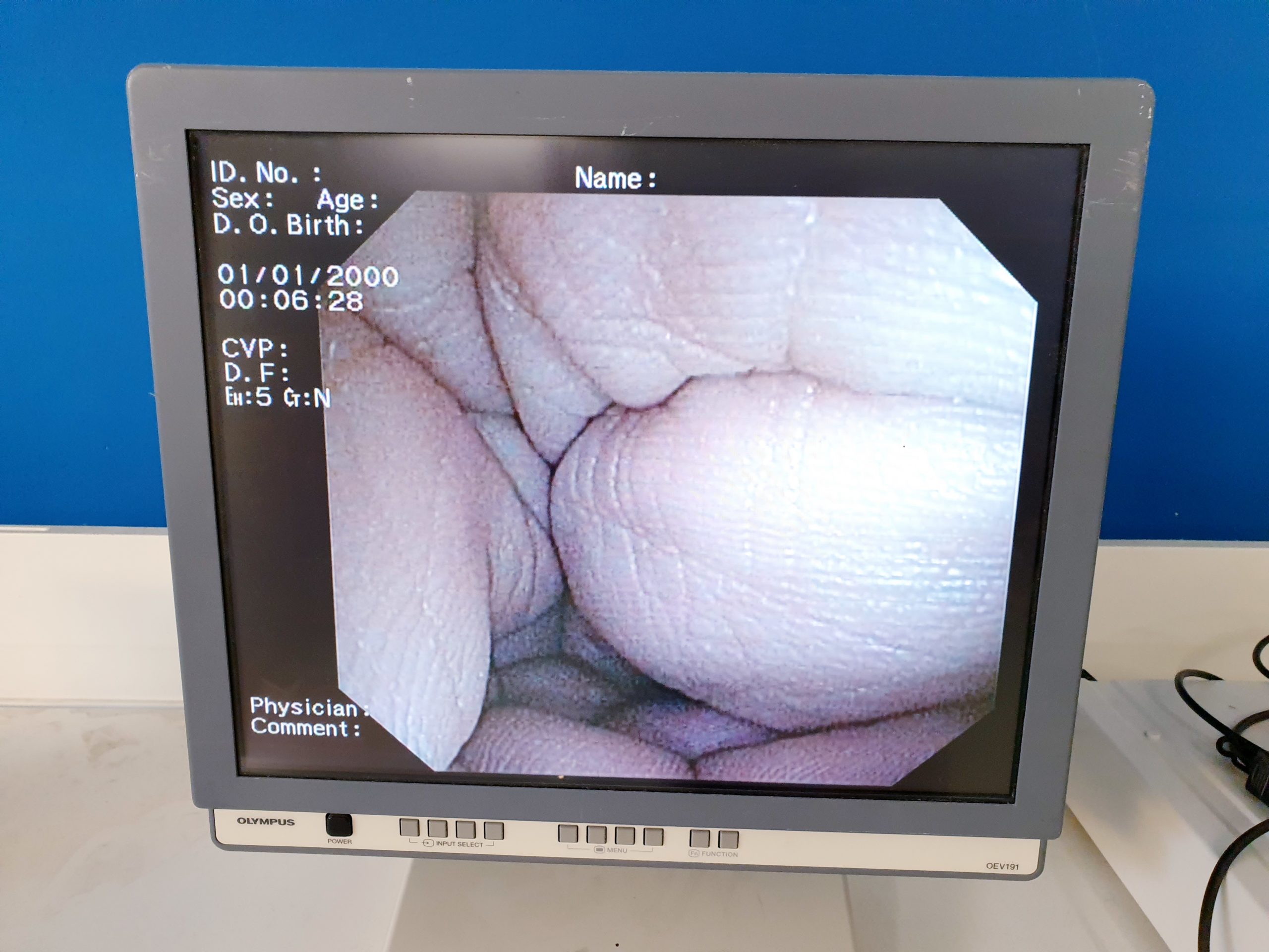 Olympus CV-160, CLV160 + MAJ-843 – Endoskopie System thumbnail 8