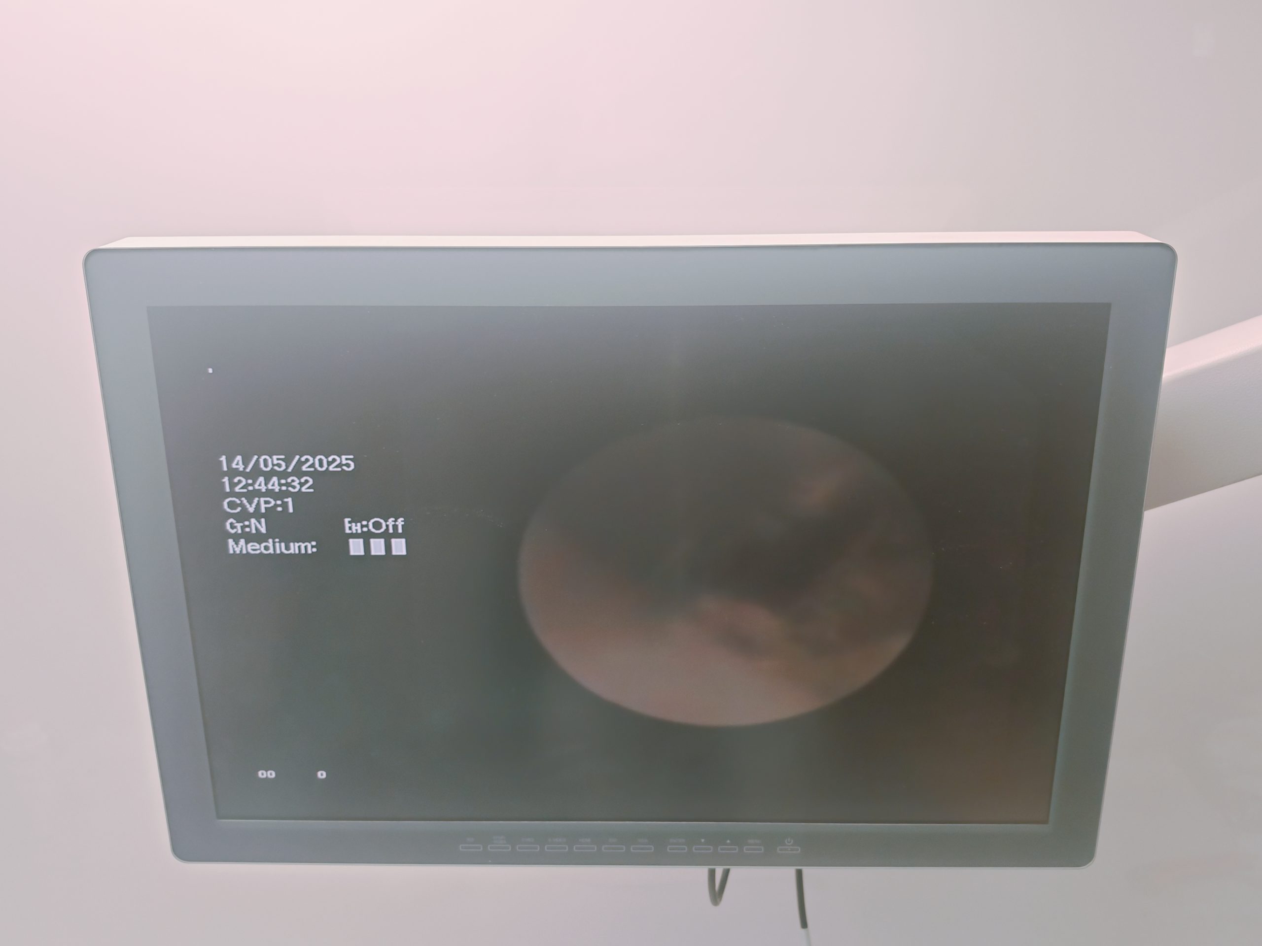 Olympus BF-XP160F Bronchoscope – Bronchoskop thumbnail 13