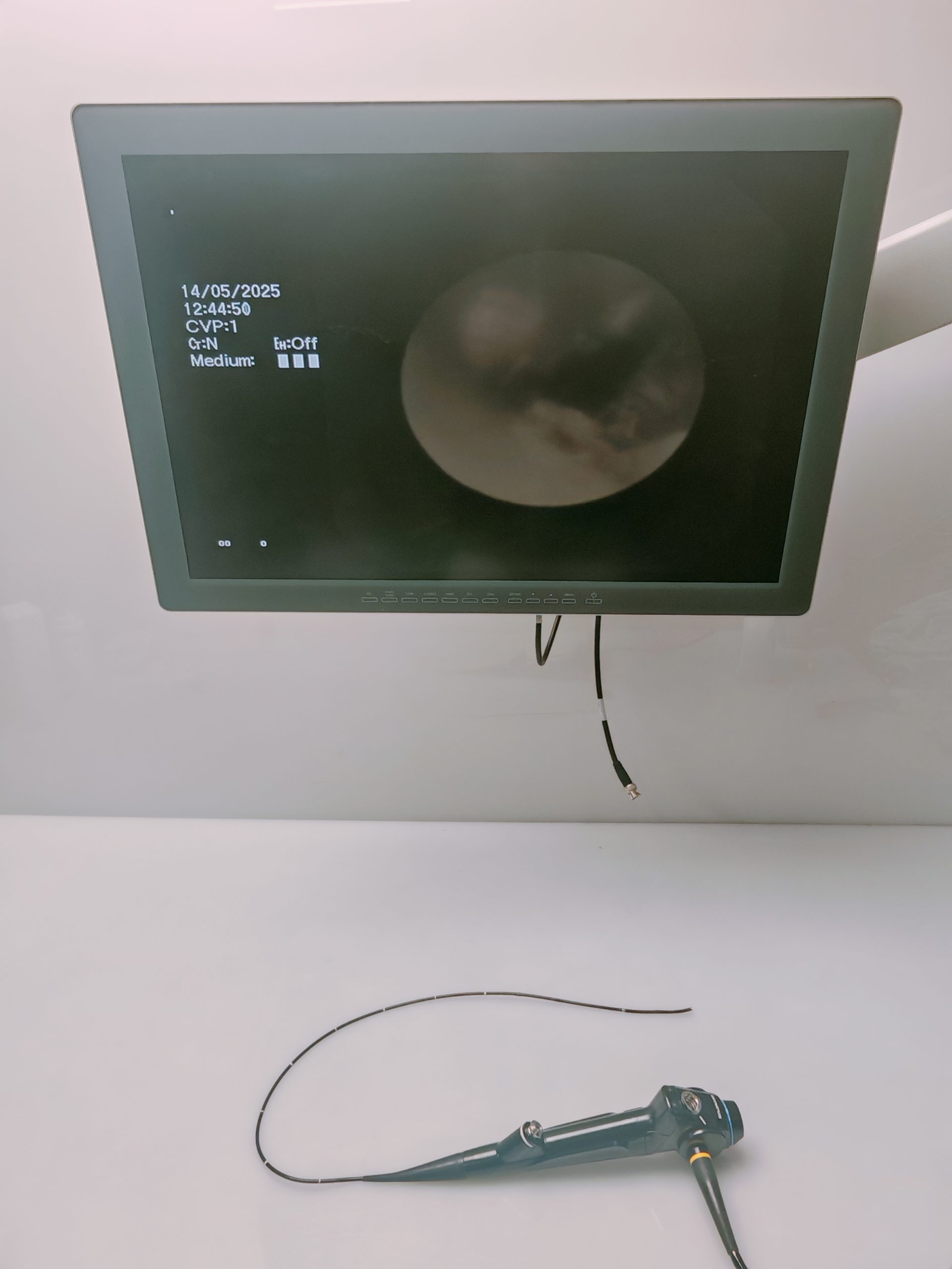 Olympus BF-XP160F Bronchoscope – Bronchoskop thumbnail 14