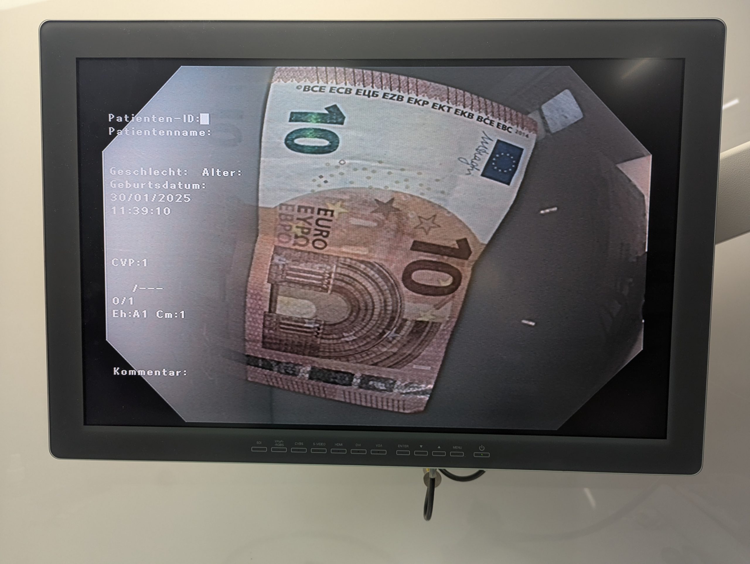 Olympus GIF-HQ190 EVIS EXERA III Video Gastroskop thumbnail 19