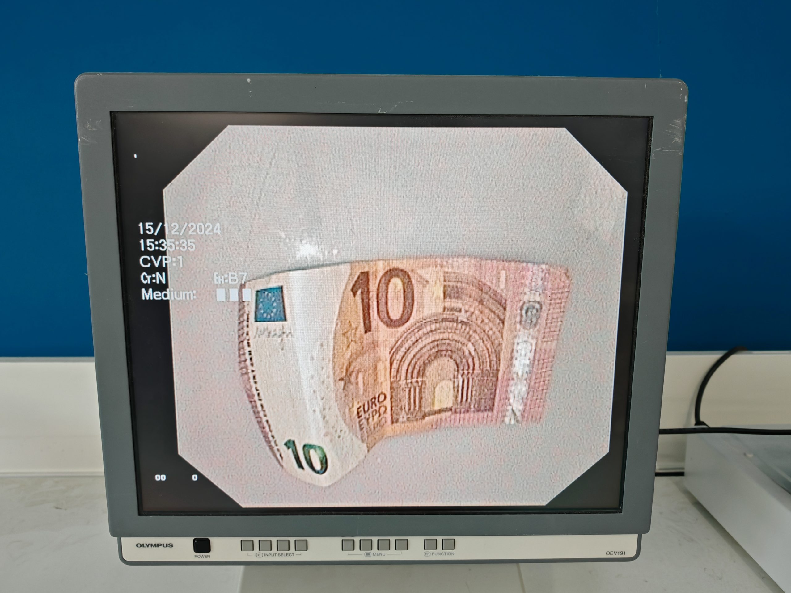 Olympus GF-UCT180 Longitudinales Ultraschallgastroskop – defekt thumbnail 20
