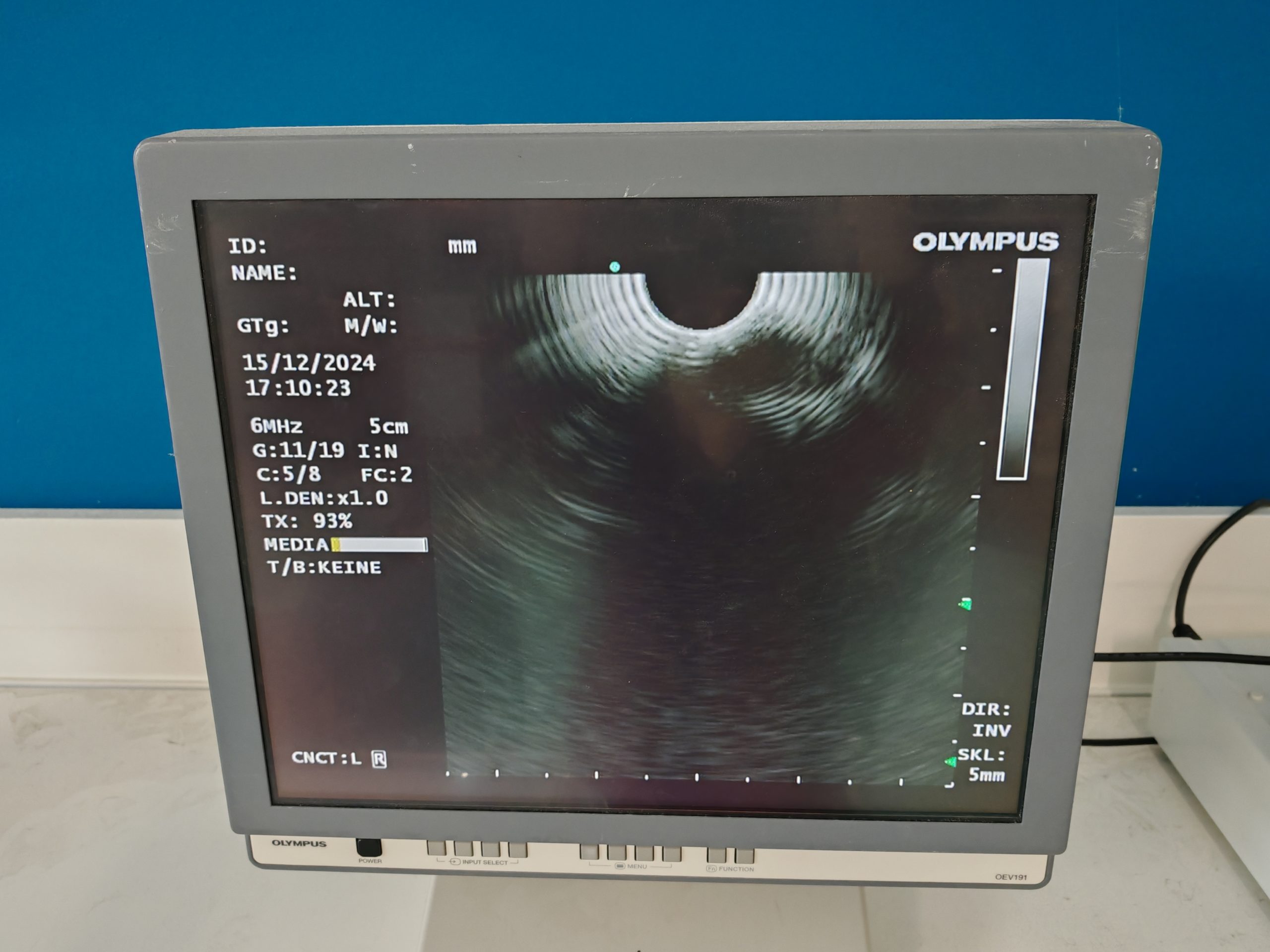 Olympus GF-UCT180 Longitudinales Ultraschallgastroskop – defekt thumbnail 21