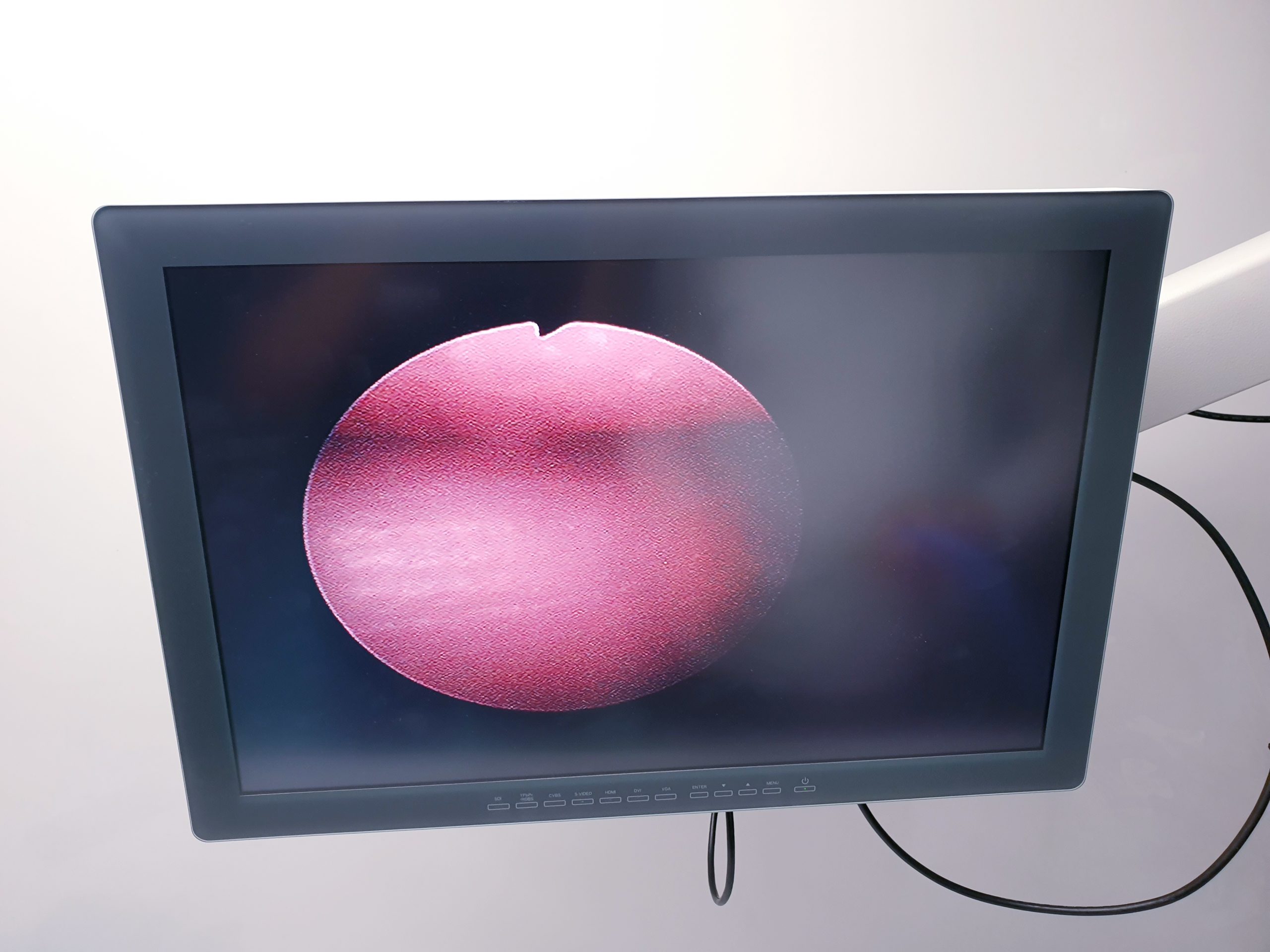 Olympus A70961A Arthroscope 30° 2.7 mm 160 mm thumbnail 6