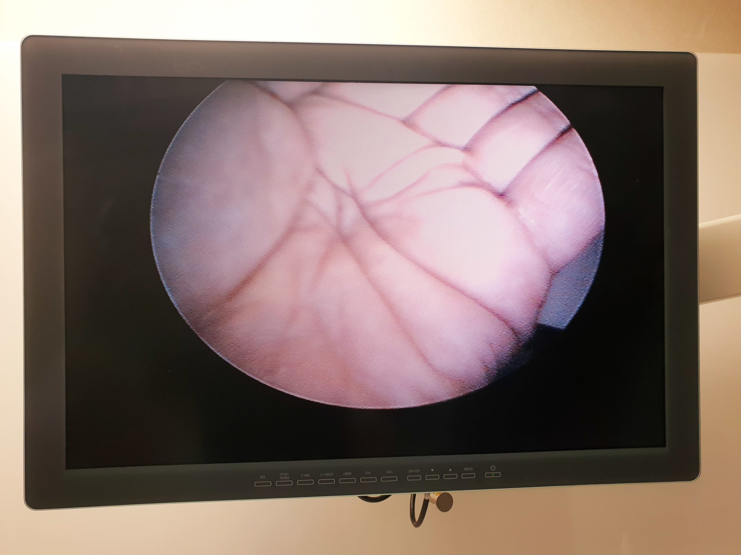Richard R. WOLF 8840.401 Endoskop, Laparoskop, Optik 40Grad thumbnail 6