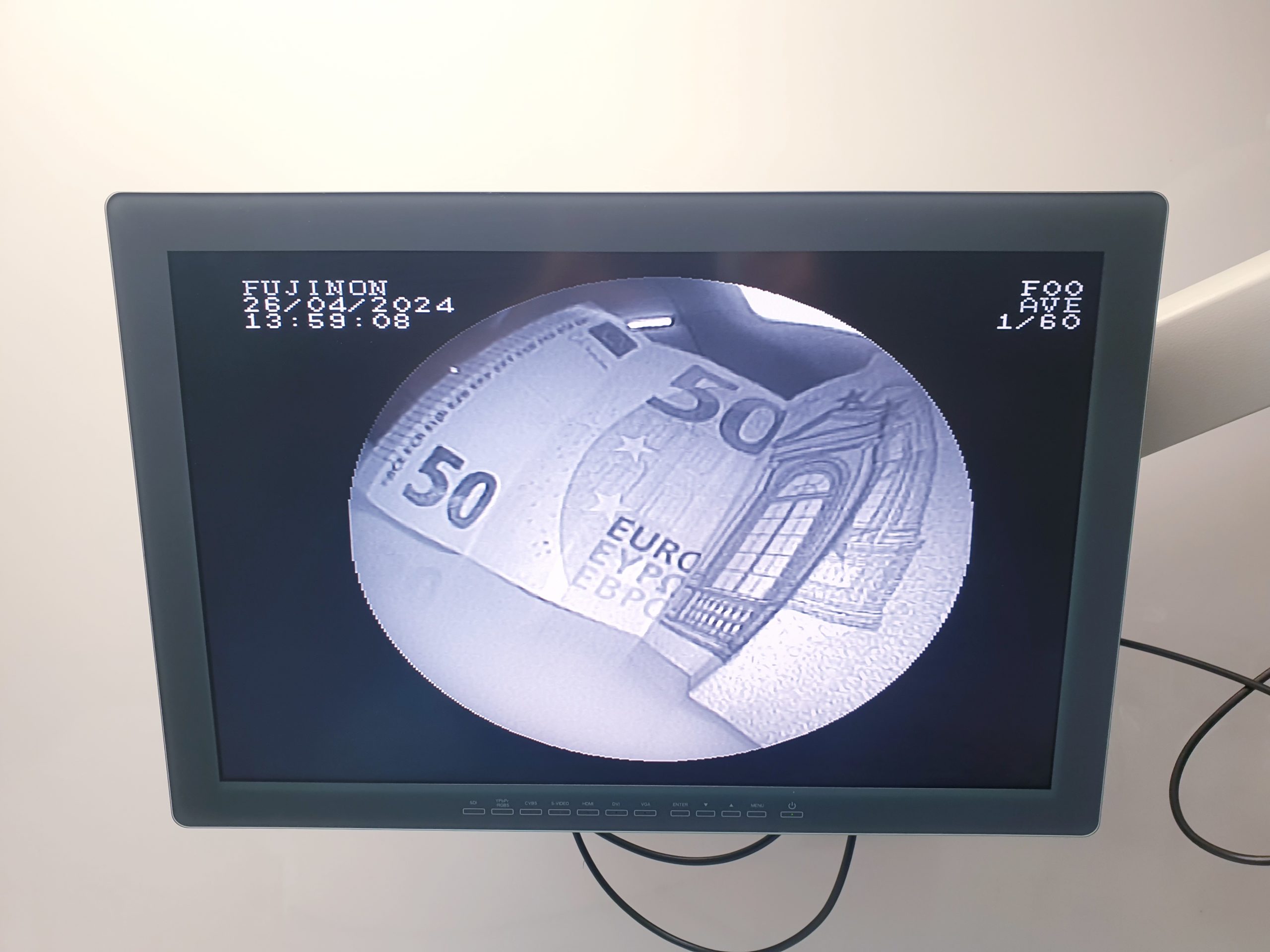 Fuji Fujinon EB-530T Therapeutisches Bronchoskop thumbnail 10