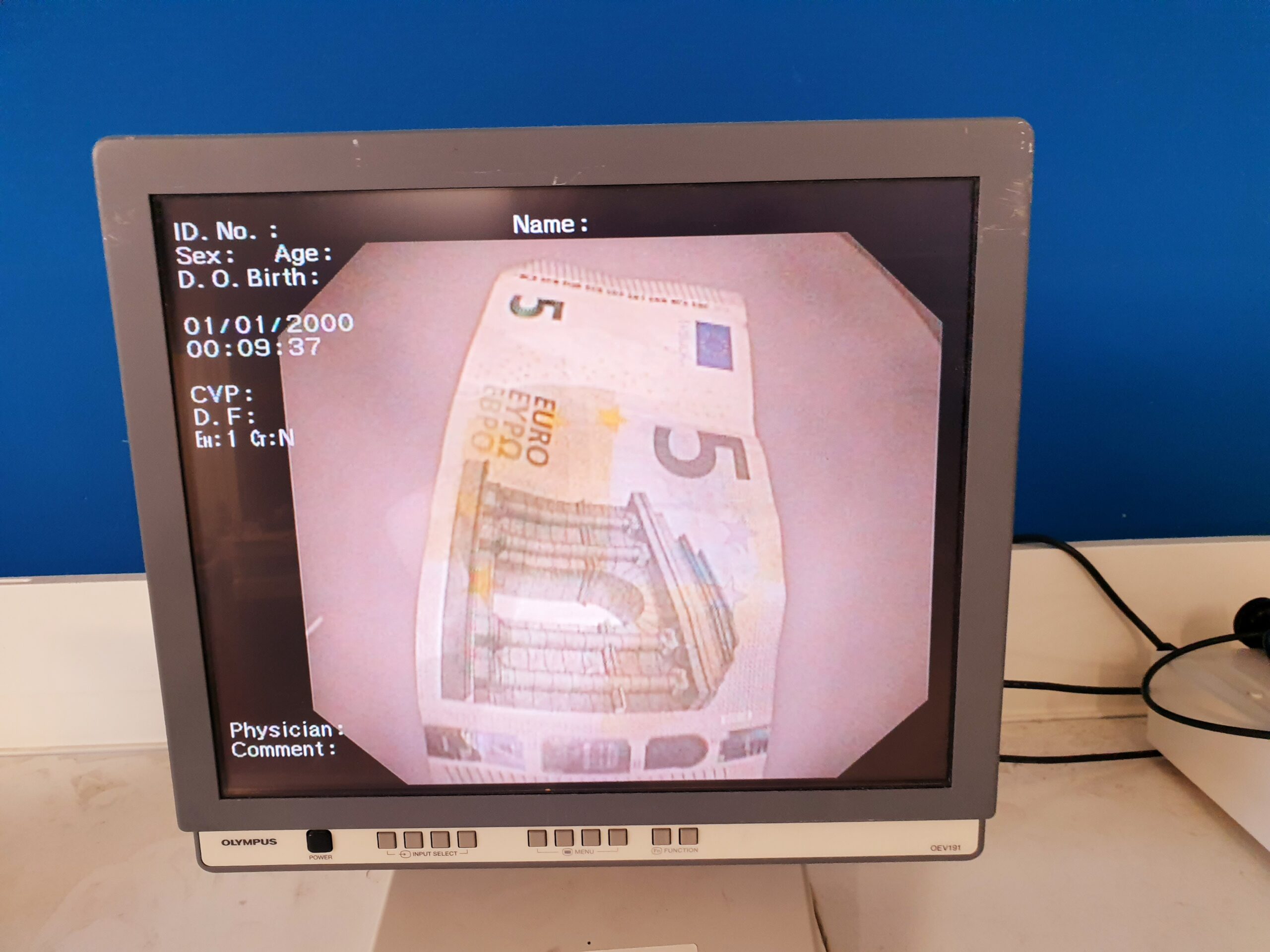Olympus CV-160 + CLV-160 Video Endoscopy System thumbnail 2