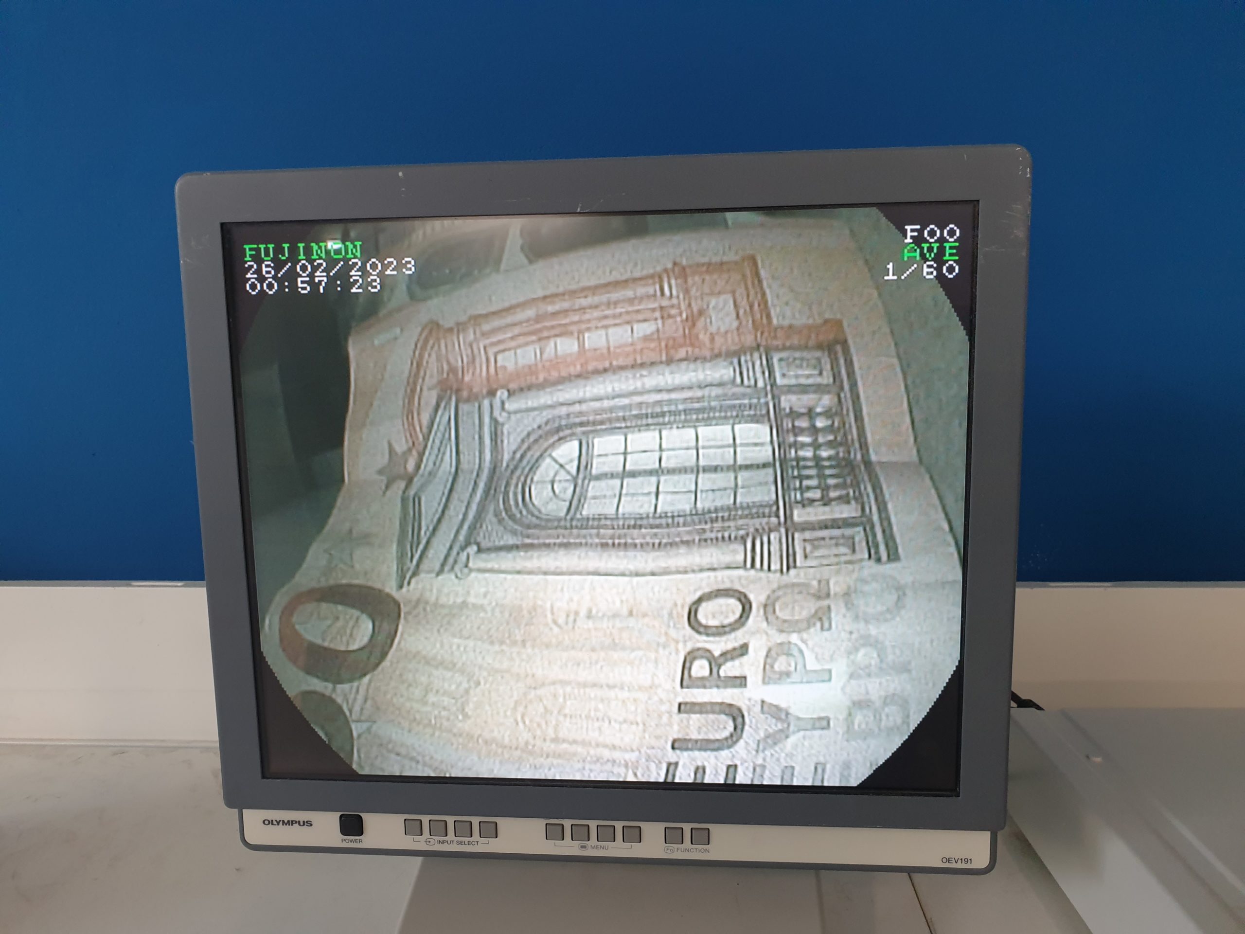 Fujinon ED-530XT8 Video-Duodenoskop thumbnail 15