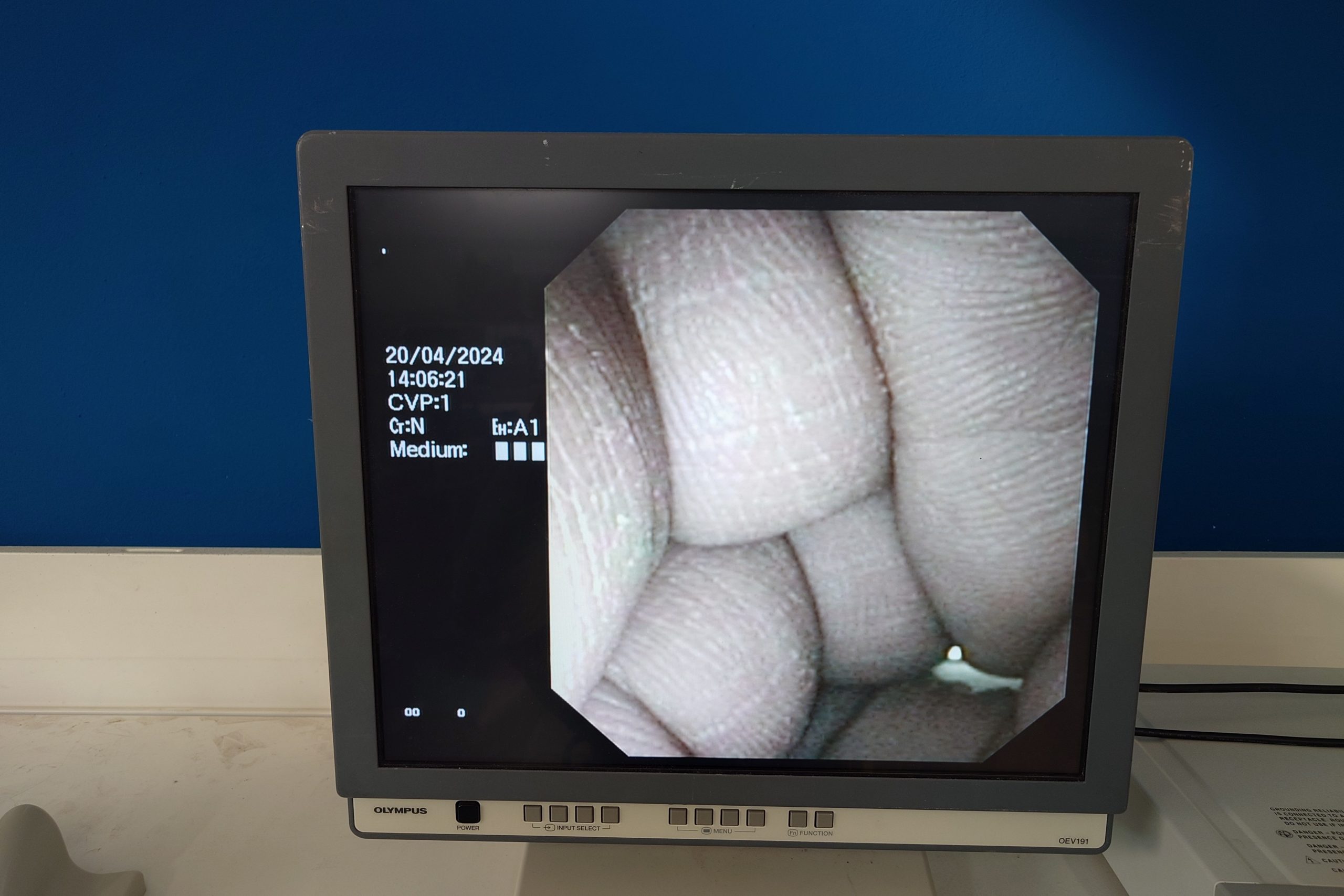Olympus GF-UCT140-AL5 thumbnail 3