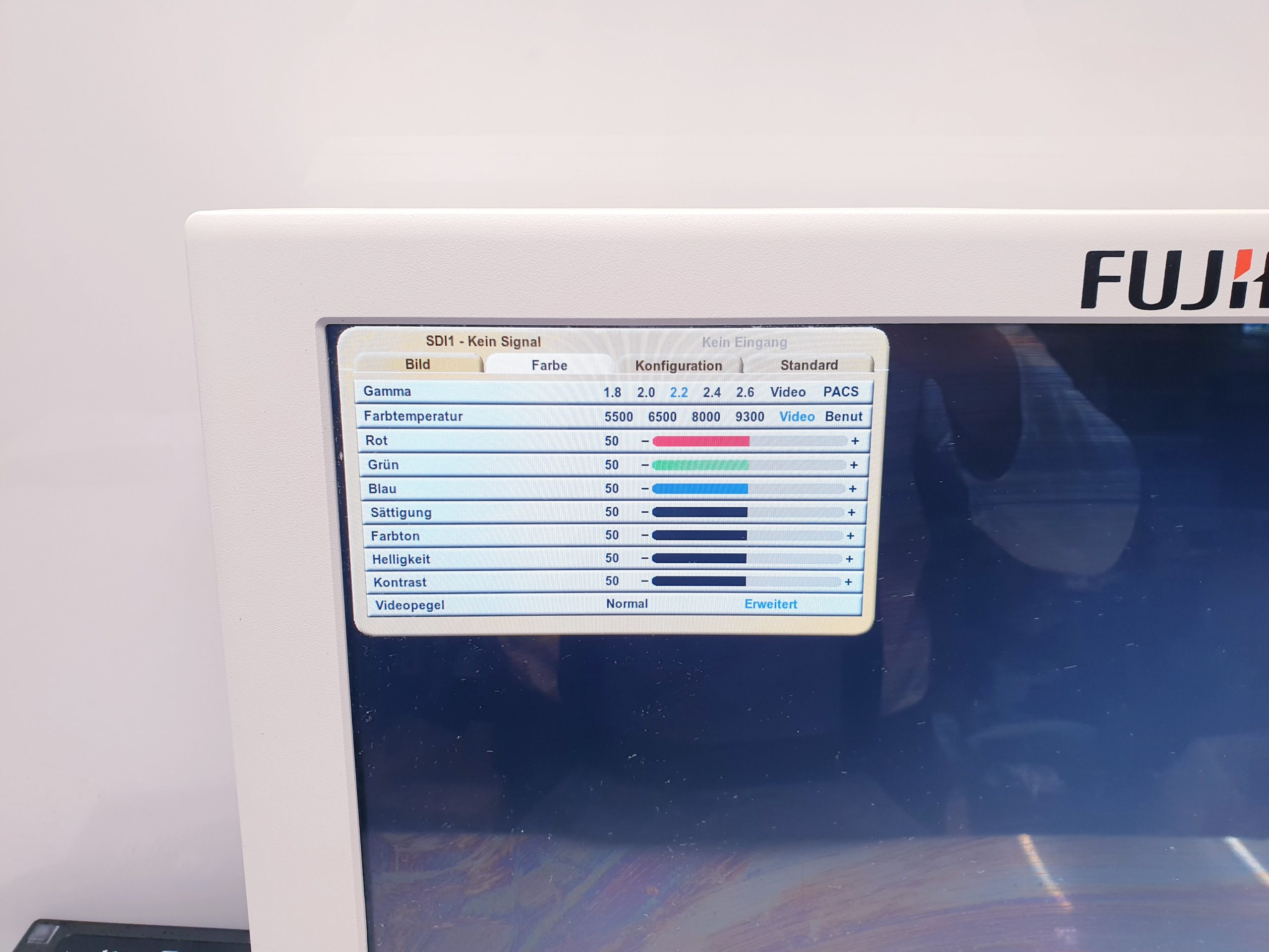 NDS SC-WU24-A1511 Full HD Monitor für die Endoskopie thumbnail 24