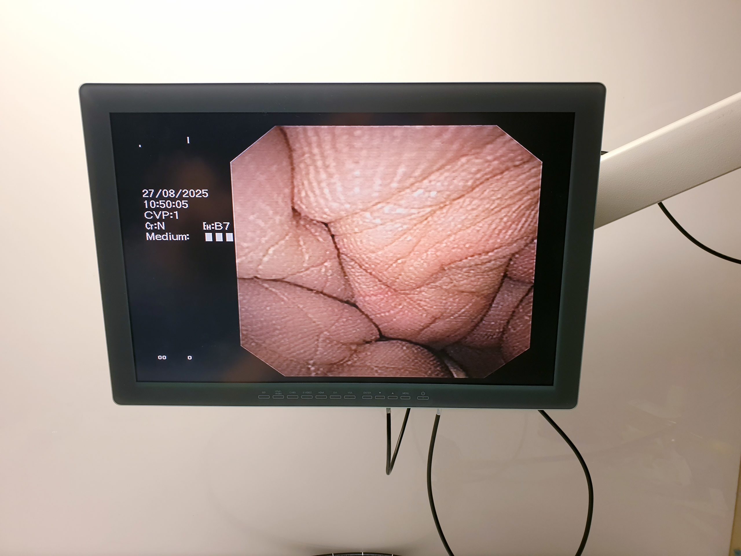Olympus GF-UCT140-AL5 ULTRASONIC GASTROVIDEOSCOPE thumbnail 16