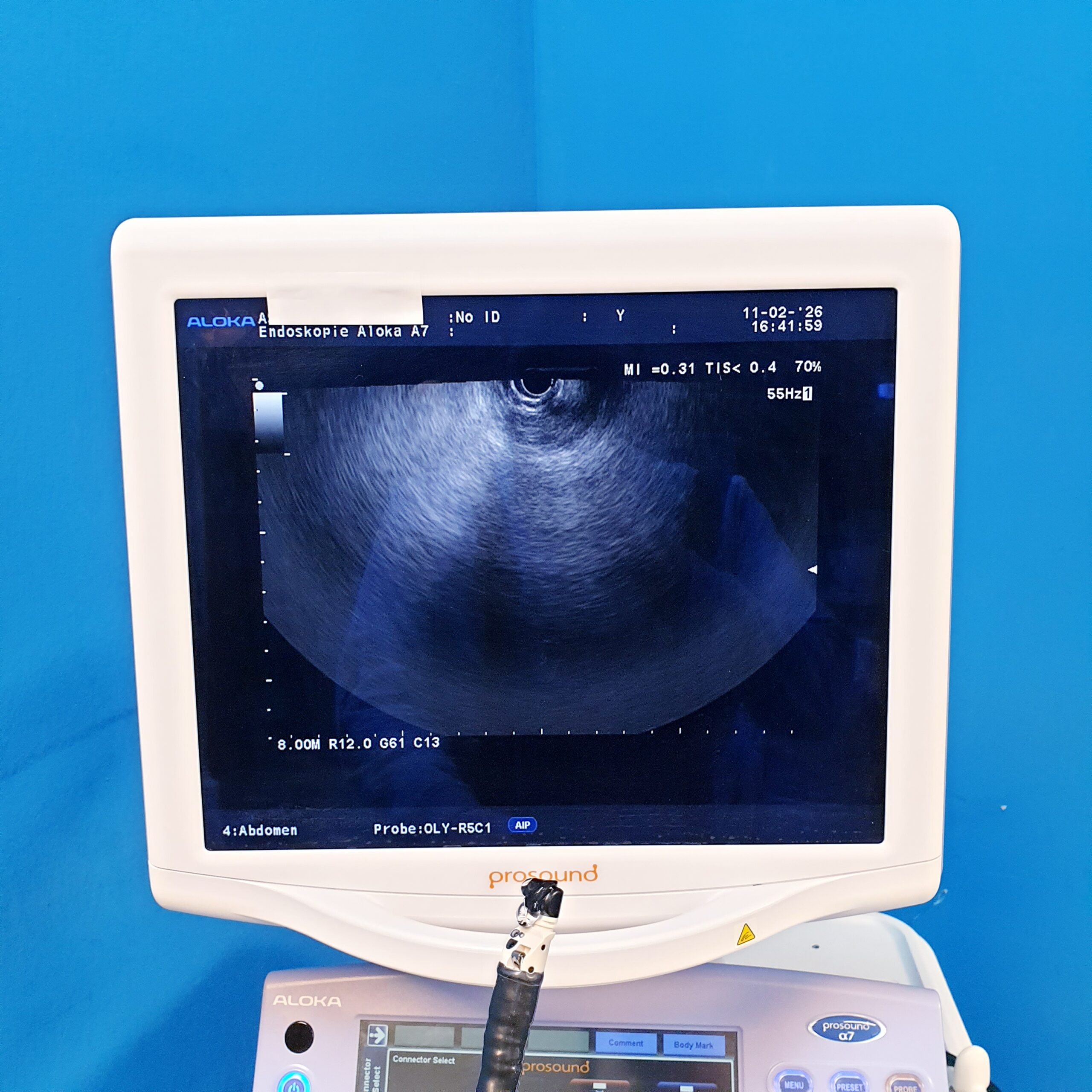 Olympus GF-UCT140-AL5 ULTRASONIC GASTROVIDEOSCOPE thumbnail 25