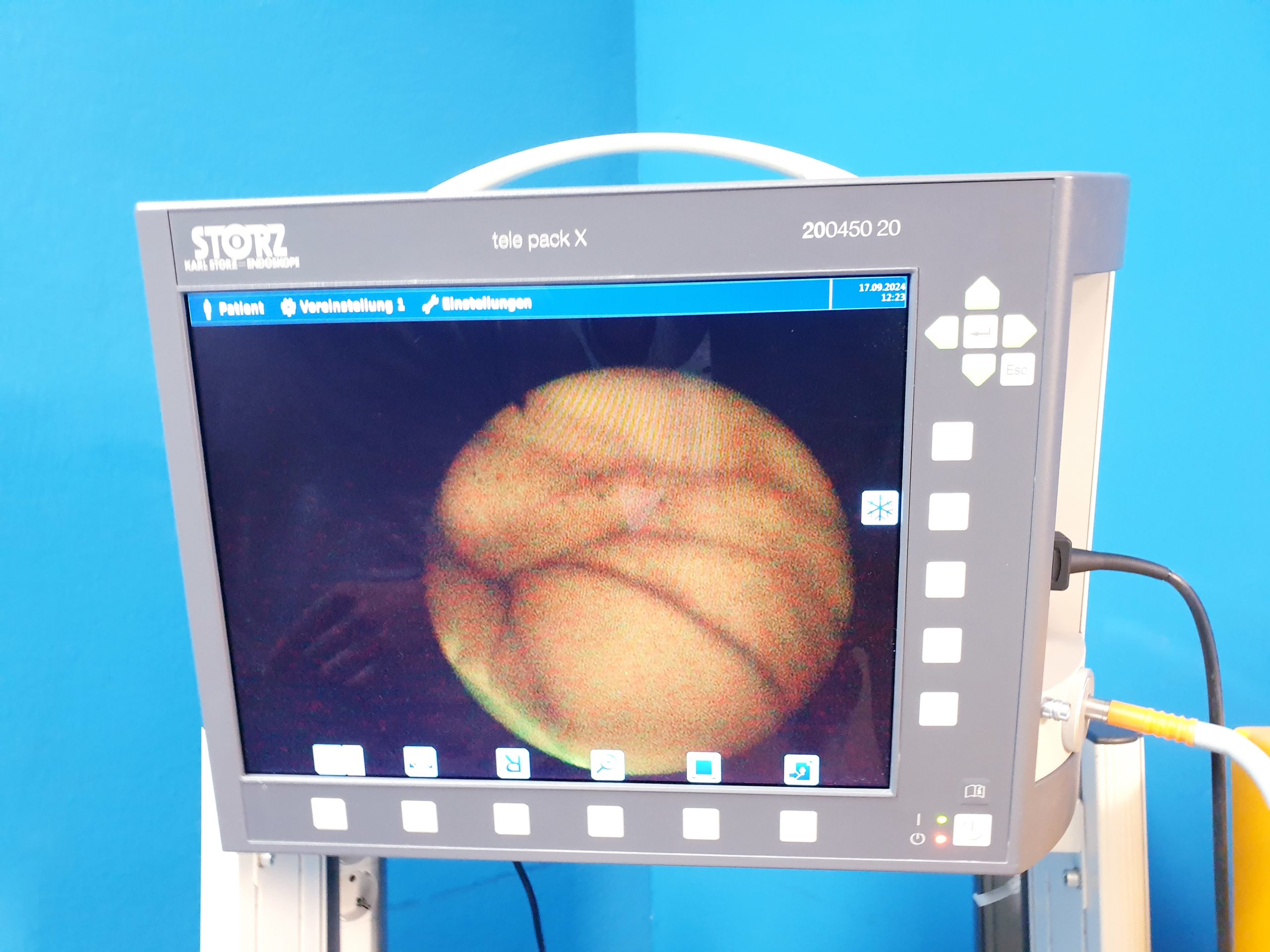 Karl Storz 11001BN1 Fibrobronchoskope thumbnail 2