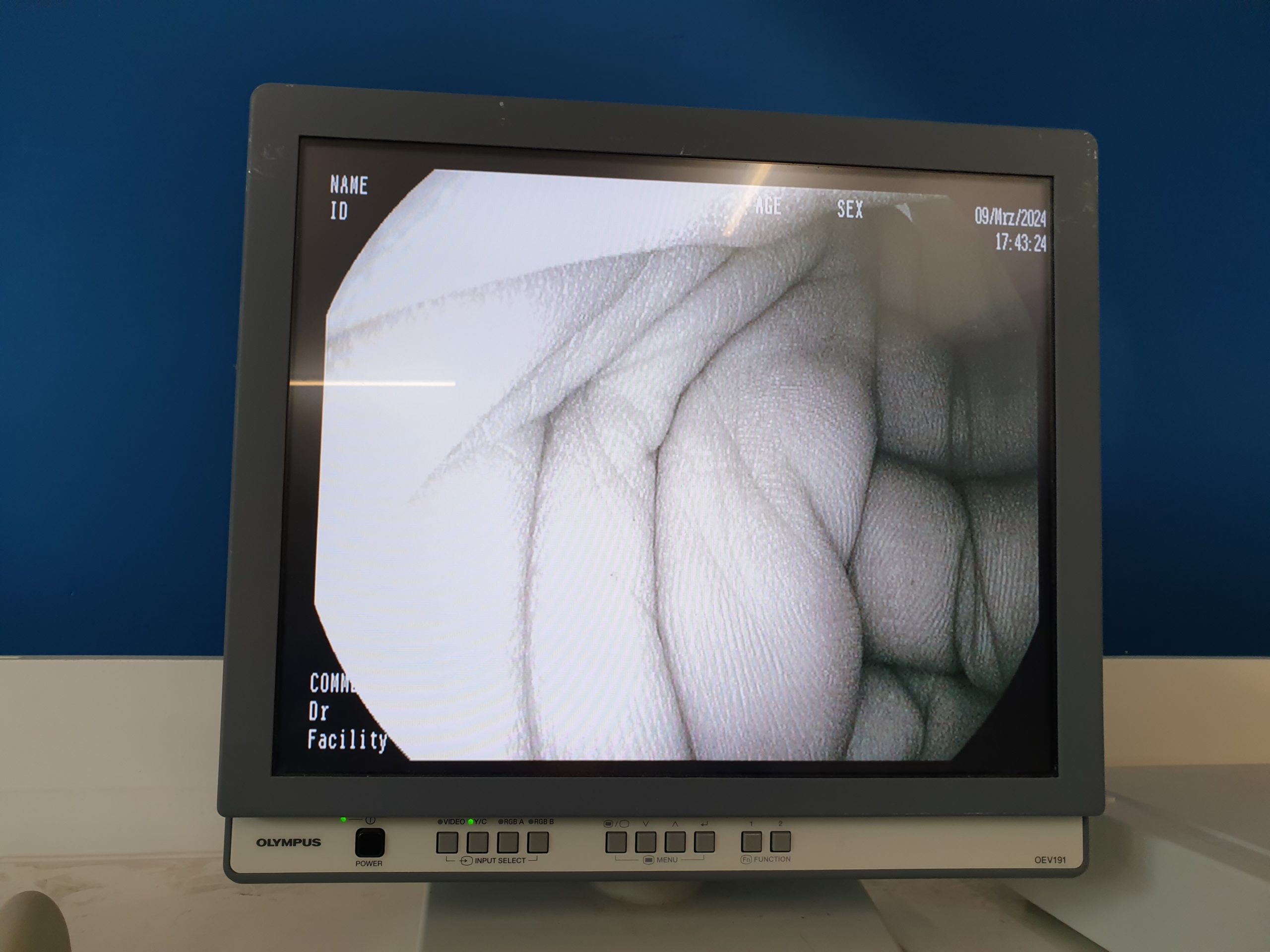 Pentax EG-2990I EG 2990 i Videogastroskop Gastroskop geprüft thumbnail 12